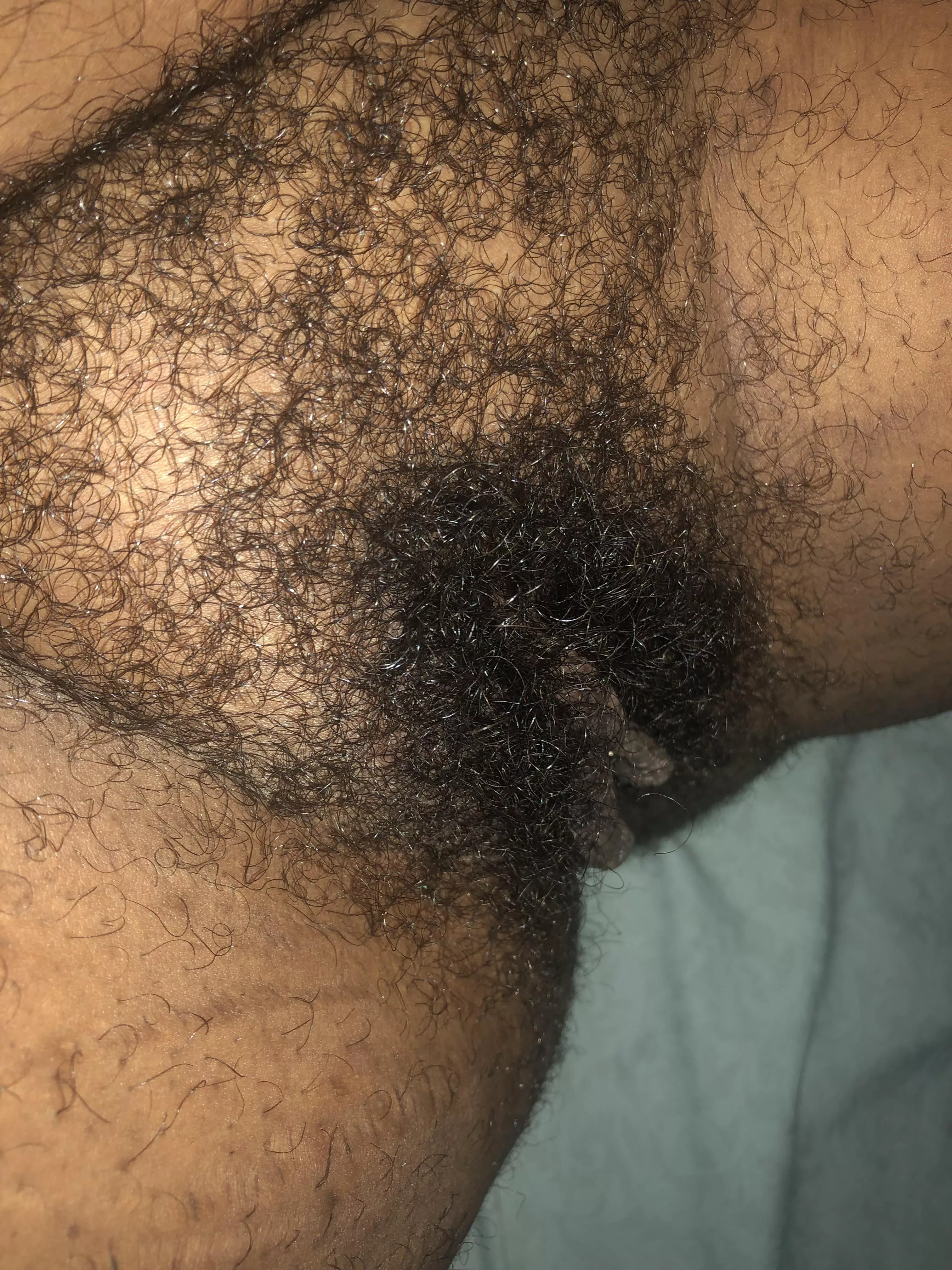 I’m hairy because I love my curls 💖 posted by PearNectar