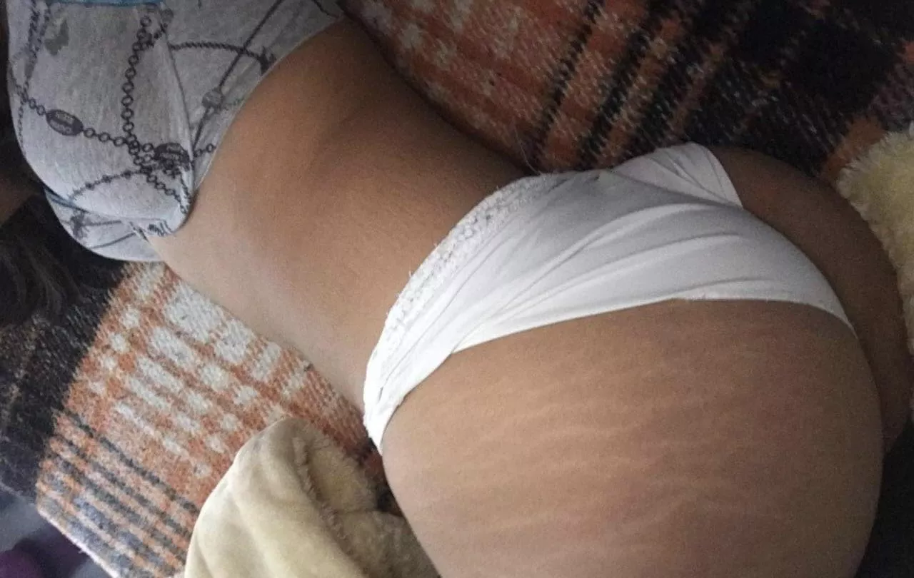 In the past I felt insecure about my stretch marks but now I love them posted by sahra___2