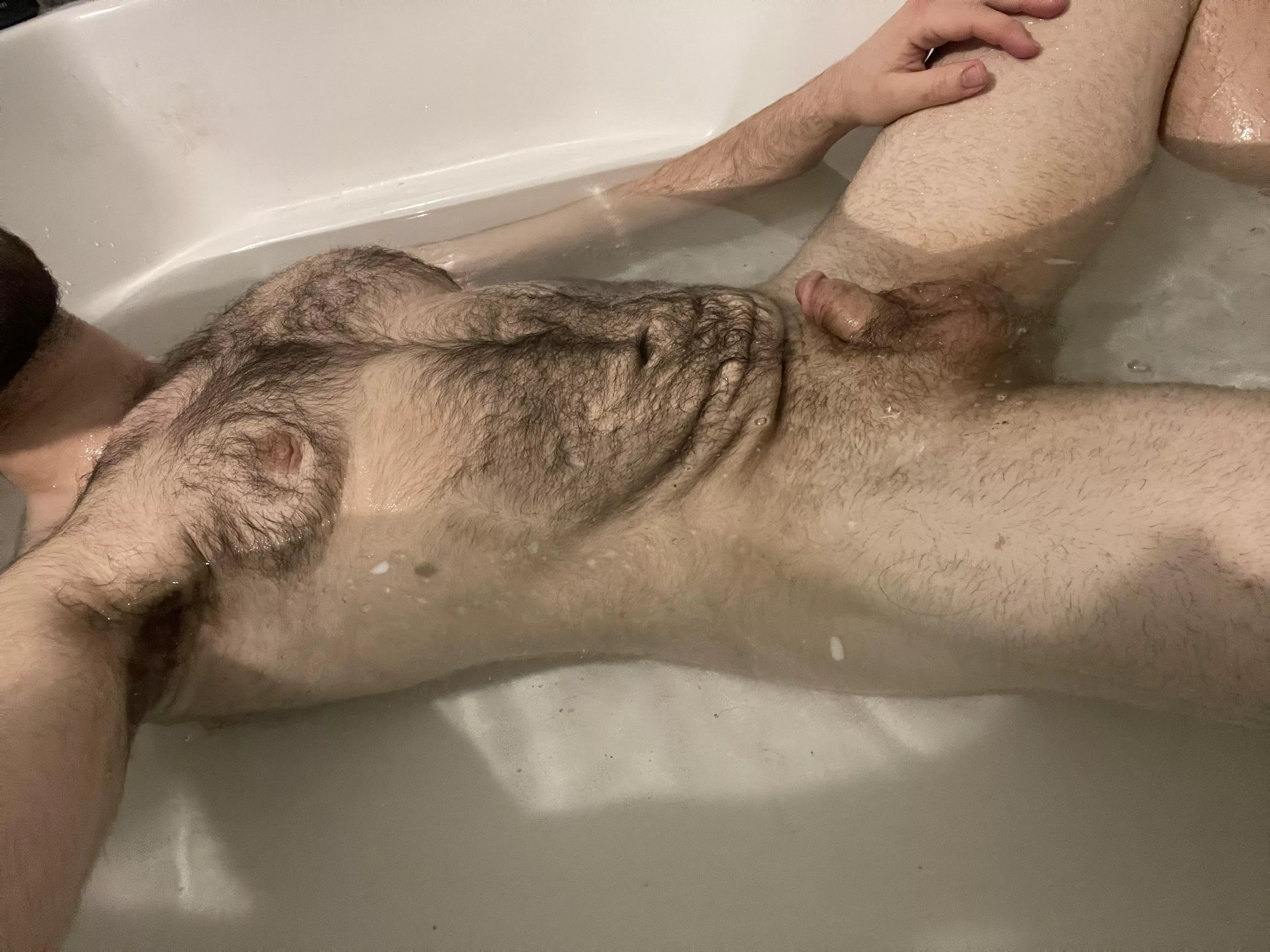 Is loose skin welcome here? posted by hydrocasket