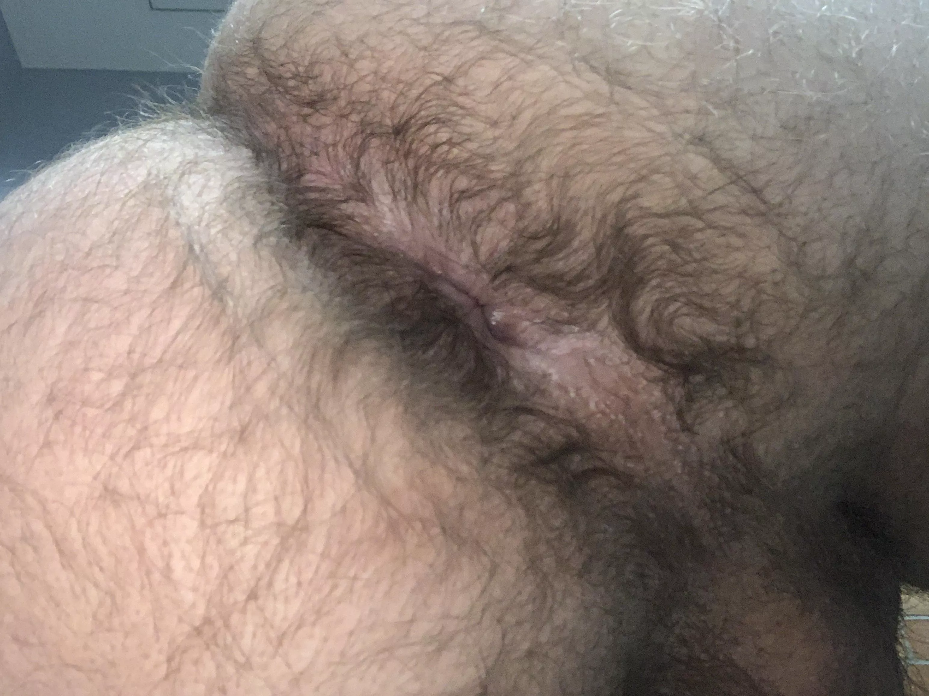 Is this hairy enough for this subreddit? posted by SlavicScientist