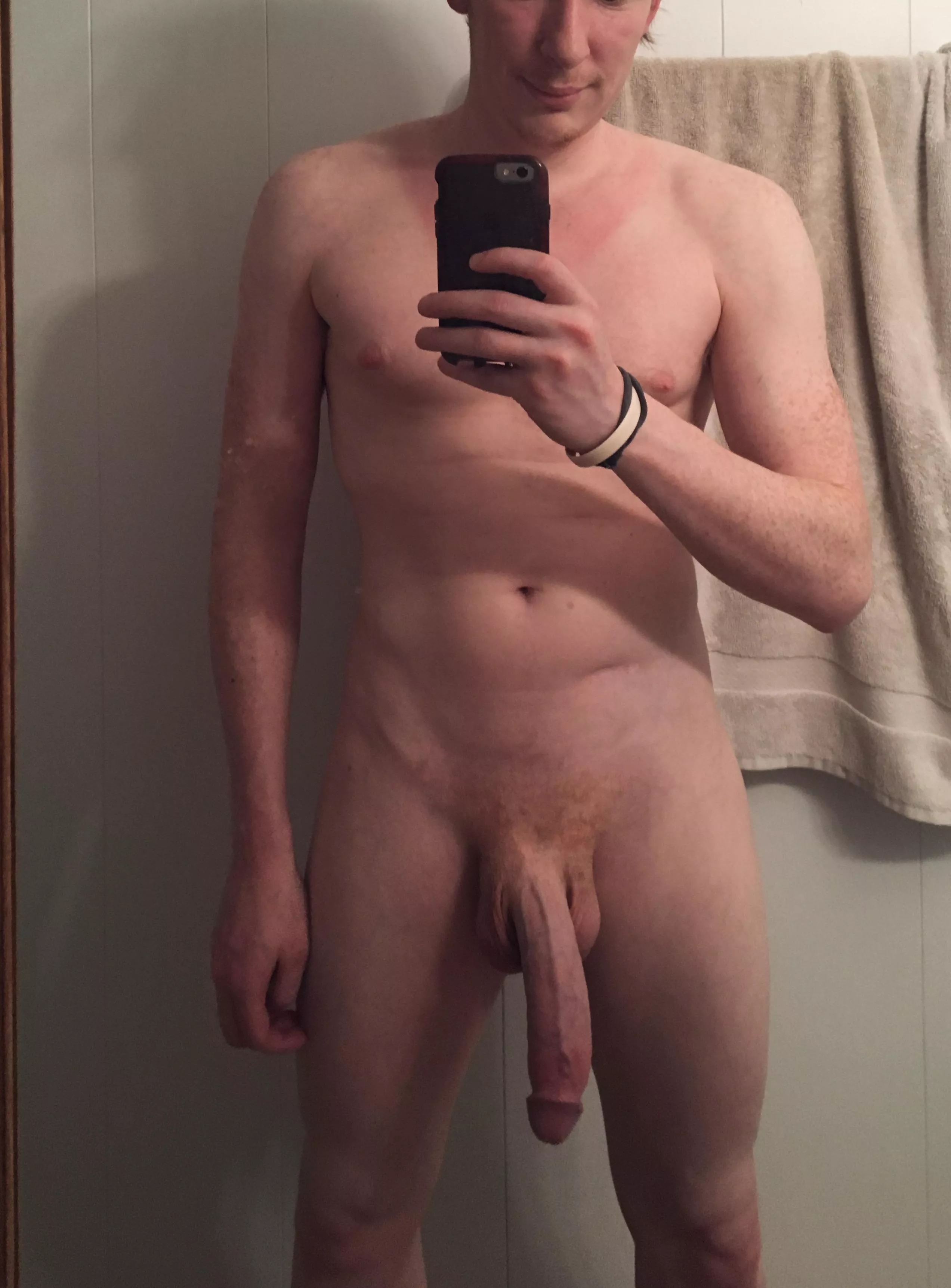 It’s just a little sunburn. 🍆 posted by InternetDouble2k