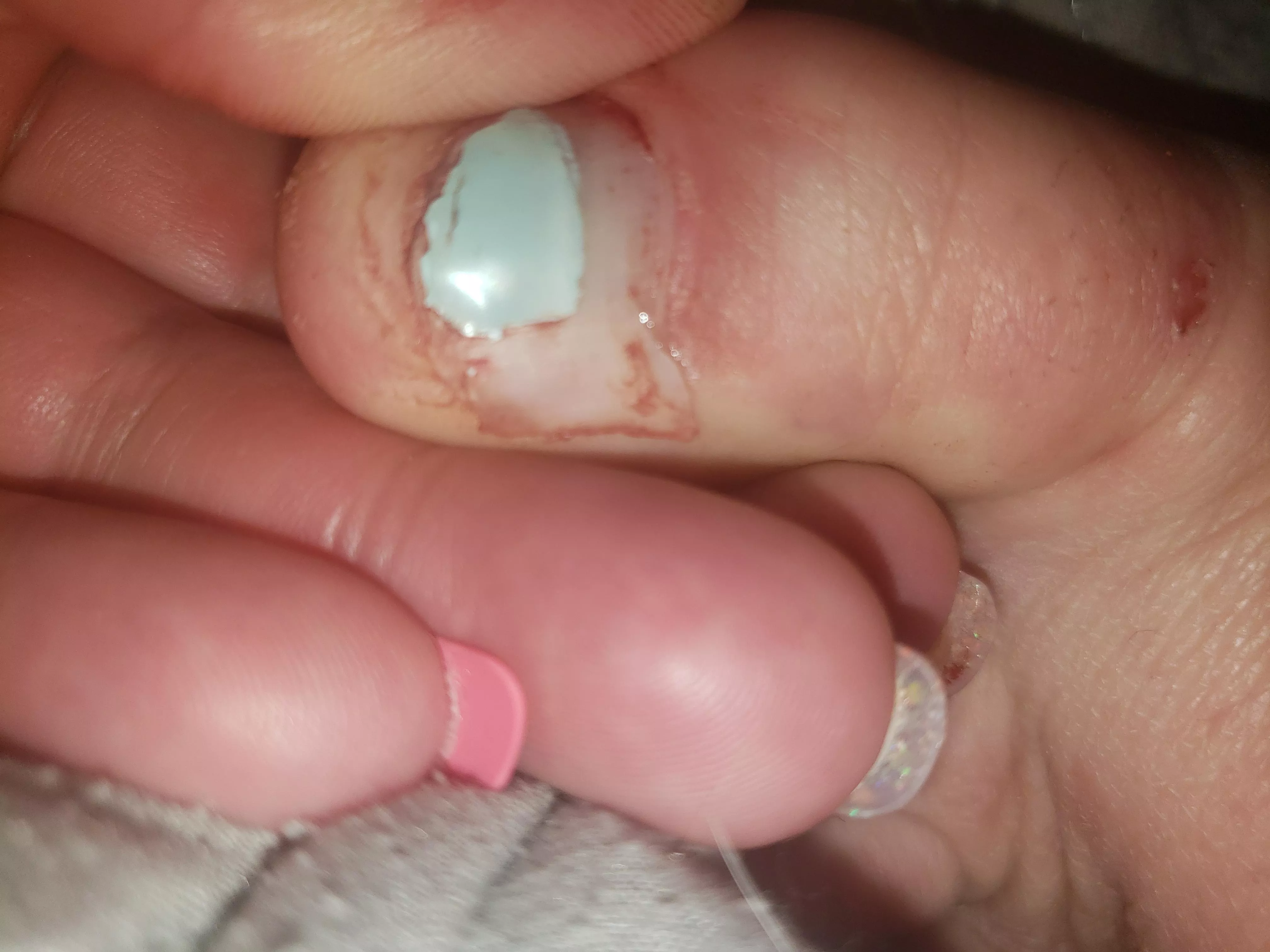 I've been gently messing with this toenail for two days and finally got it out. Now I don't know what to do with it. posted by outgrowntoenail