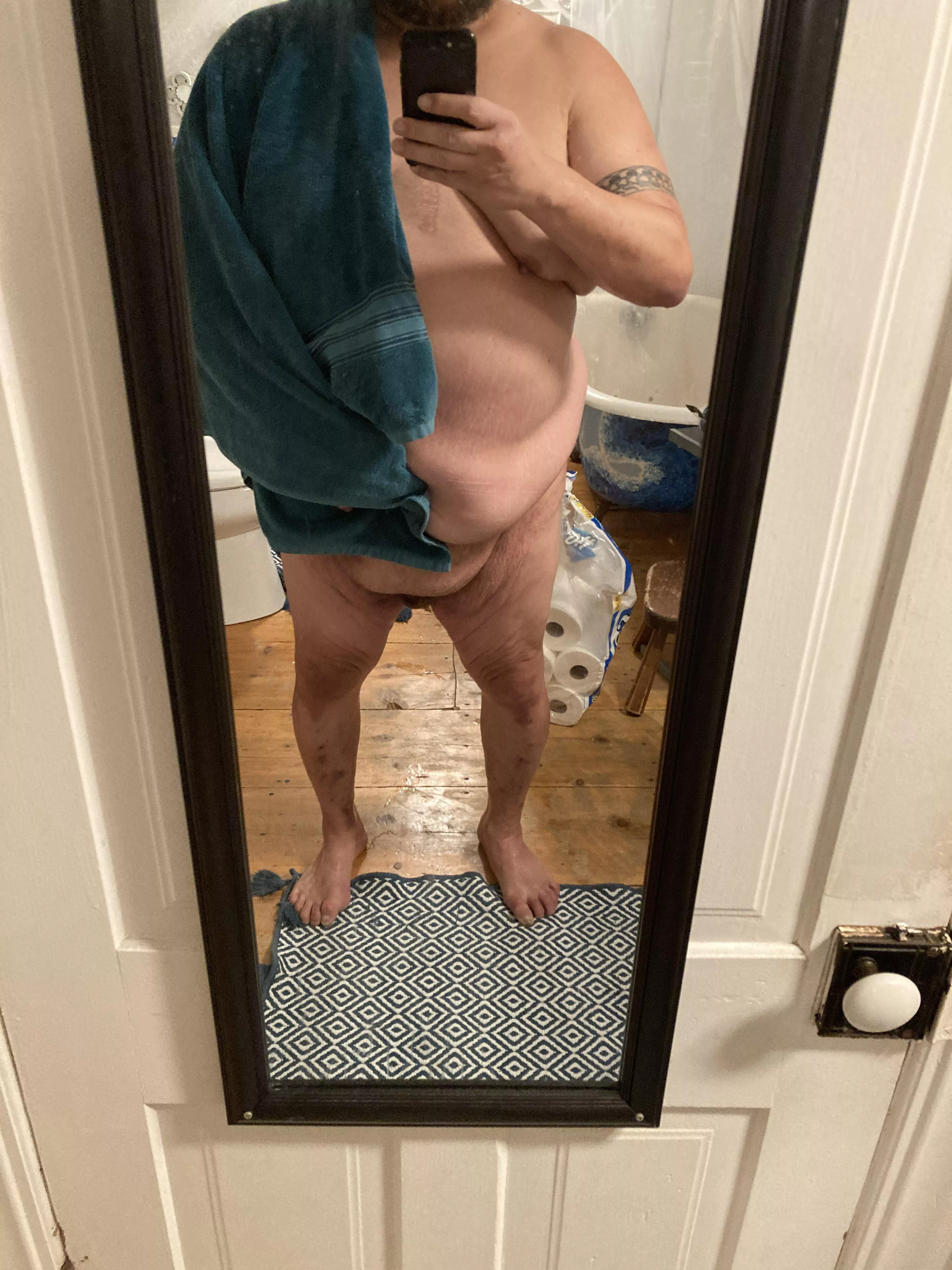 I’ve lost over 100 lbs, with 100 more to go. I’m so embarrassed with my body. Hate how fat covers my penis. When I hit goal weight, I’ll get skin surgery. I’m documenting to hopefully see you all in a year or so. posted by paulthesamoan