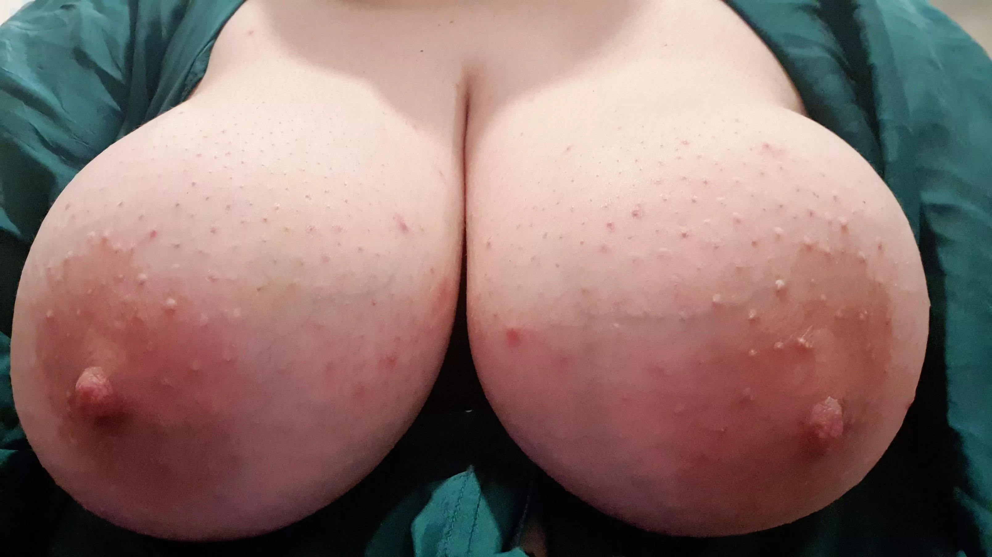 Juicy and succulent, waiting for your mouth... posted by breastsuck