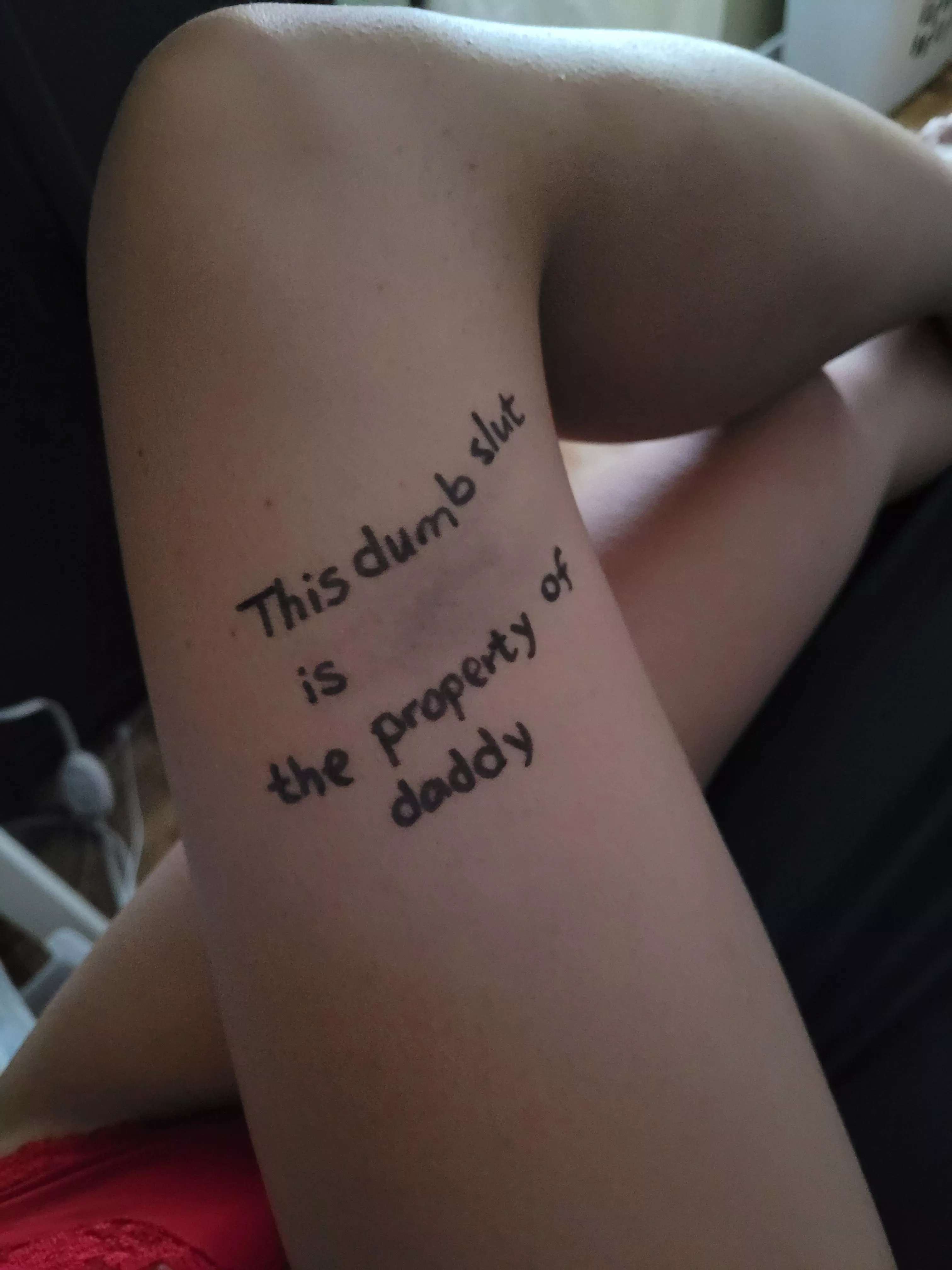 Just a tiny little whip bruise...and trying to get in daddy's good graces. posted by flopsy-babygirl