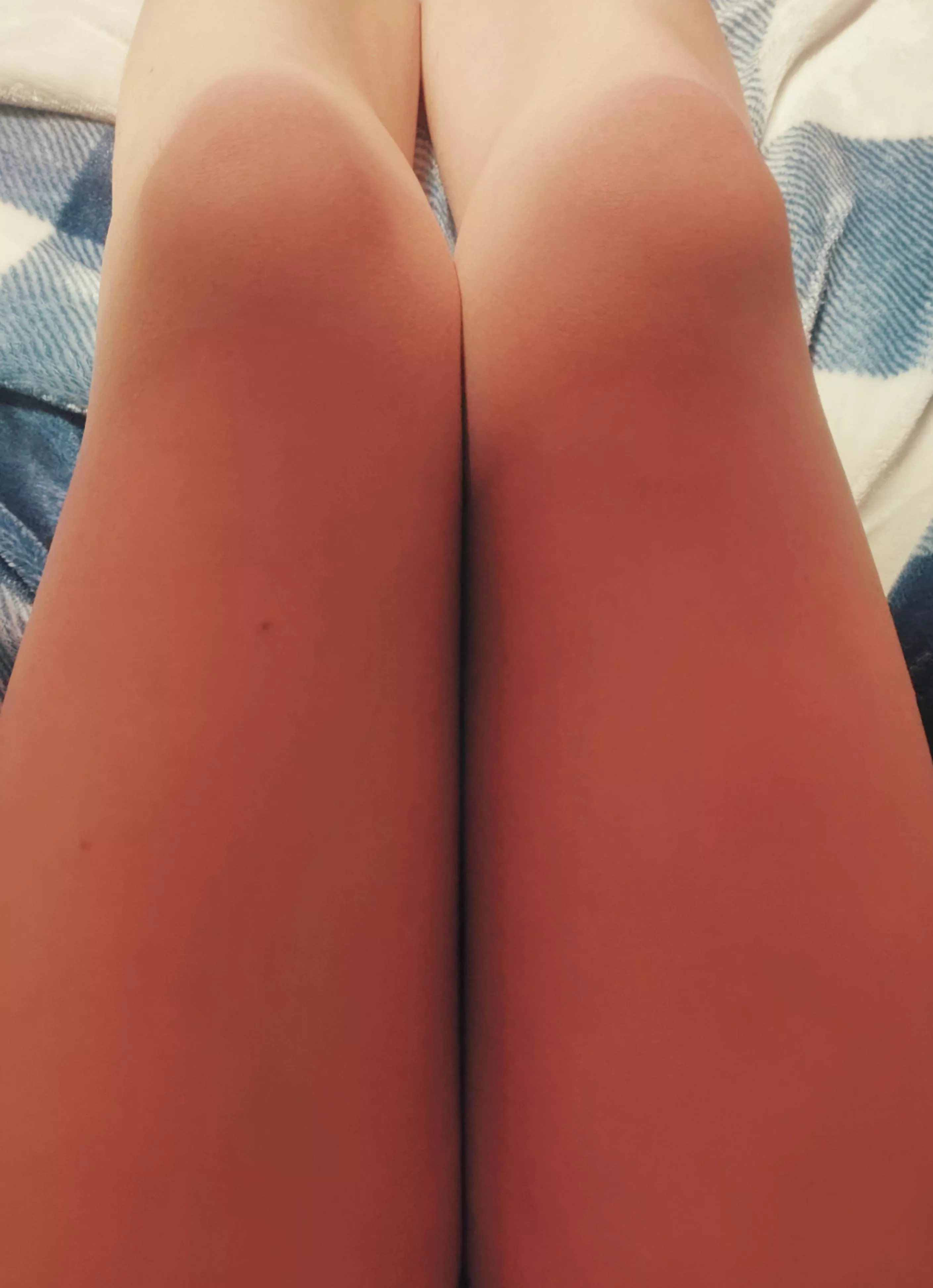 Just shaved my thighs posted by My-Name-Is-Marsh