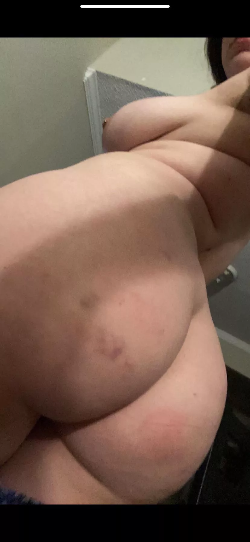 left nice and bruised [f] 🥰 posted by vagabondage_420