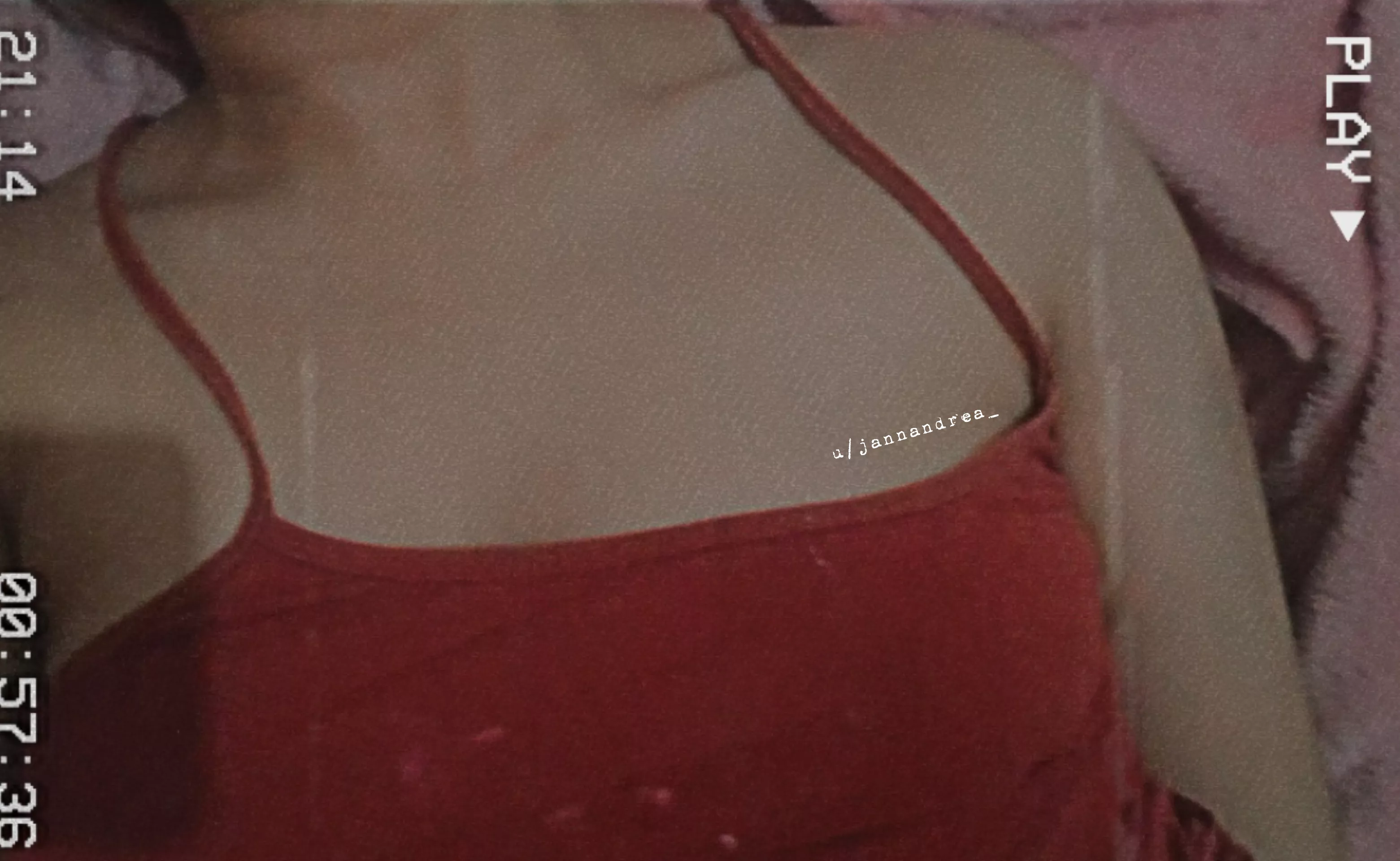 litter me with lovebites >< [f] posted by jannandrea_