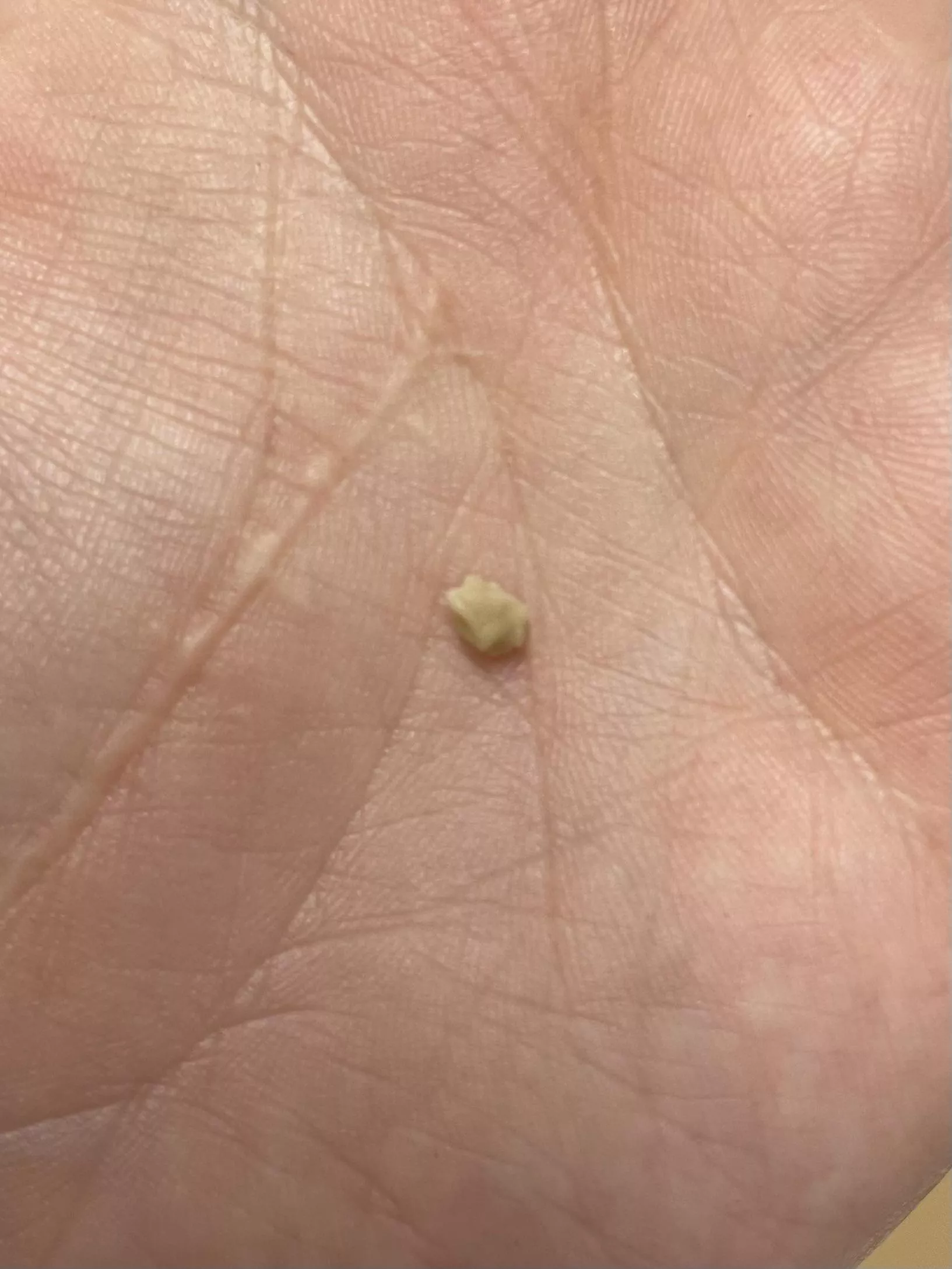 Long time lurker. Finally have something worth posting. Popped out this tonsil stone mid conversation. posted by RNHMR89