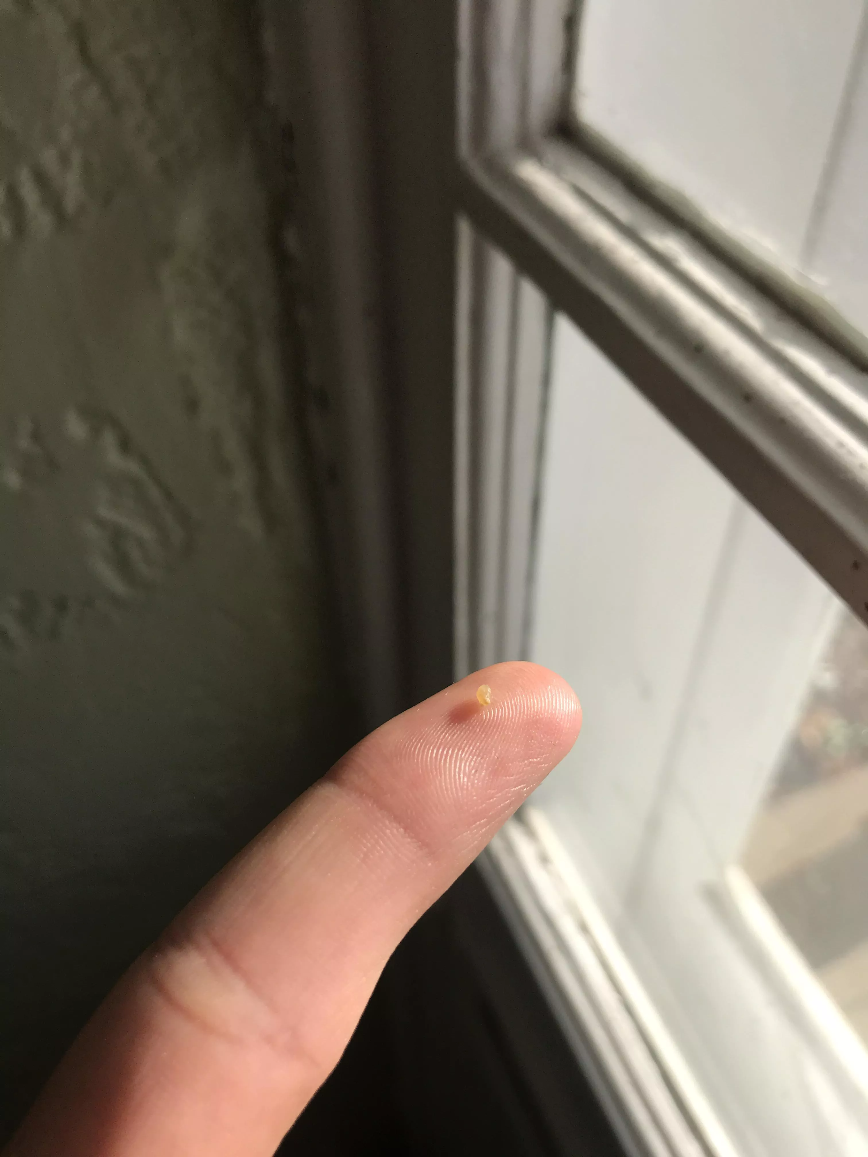 Long time lurker, first time poster. Dug this guy out of the side of my nose over the course of 6-ish months posted by RioRocketMan