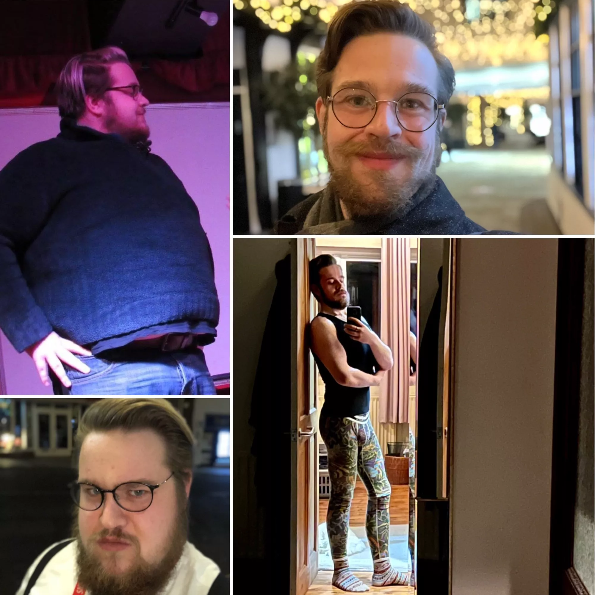 Lost almost half my bodyweight during the pandemic, still struggling to accept my body and my loose skin. I still see the me in the before pictures when I look in the mirror. posted by Njwest