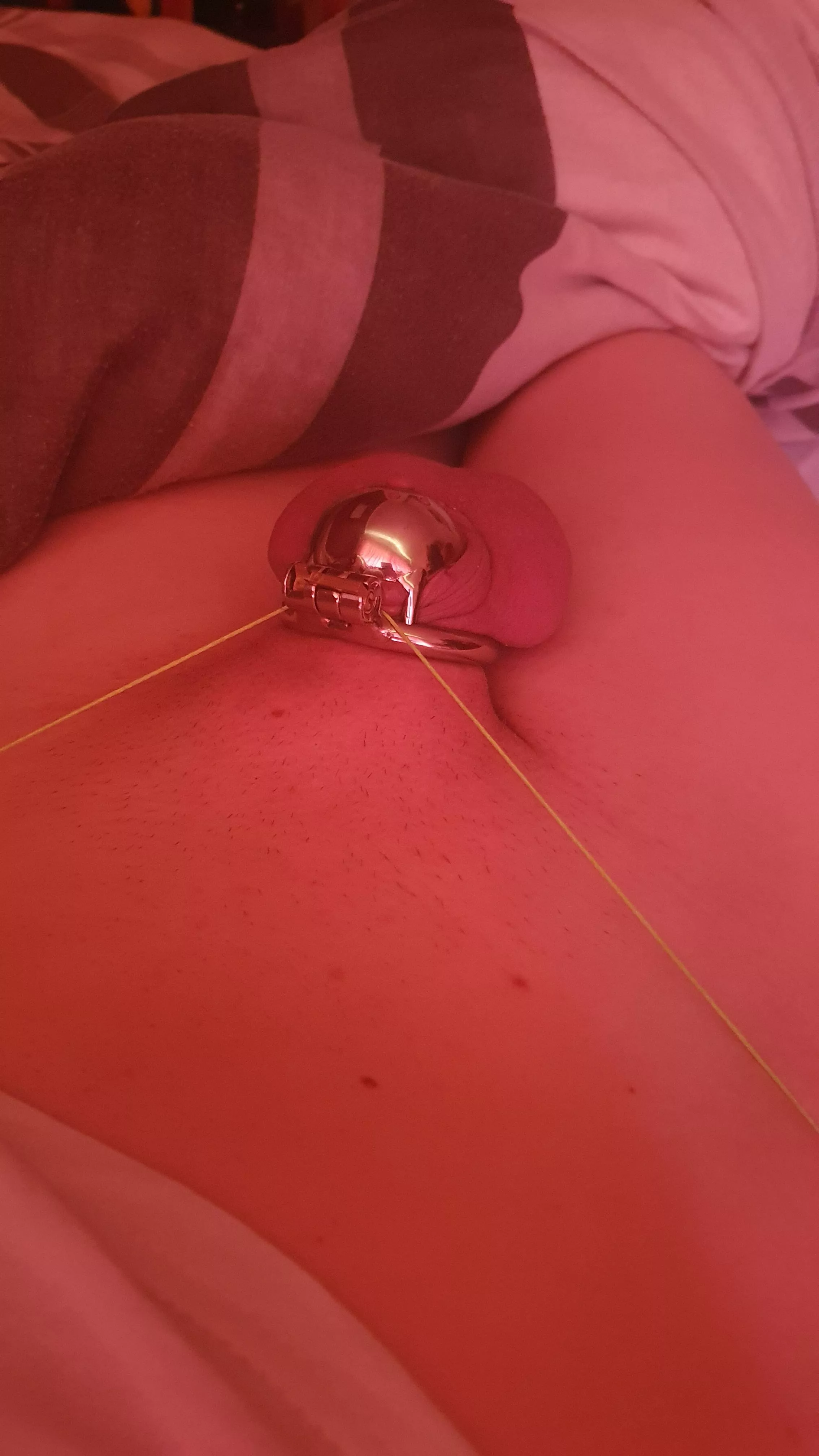 Made it through my first night pain free in my new cage 🥰🥰🥰🥰 I've always had to remove it in a lot of pain around 4am, but not this one!!!😍 posted by LexiBS