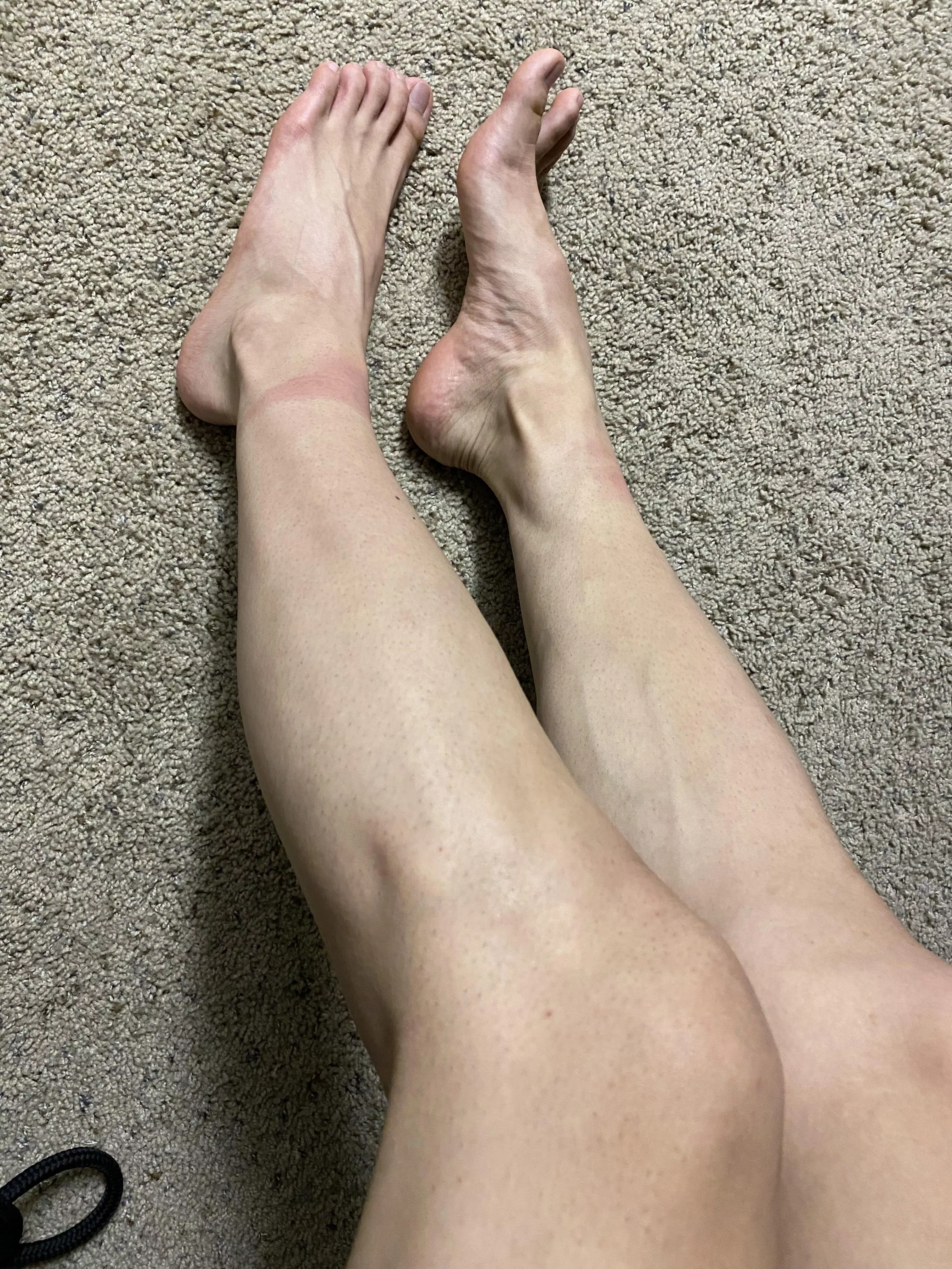 Marks on my smooth boy legs from a frogtie I was in for almost an hour posted by King_Calves