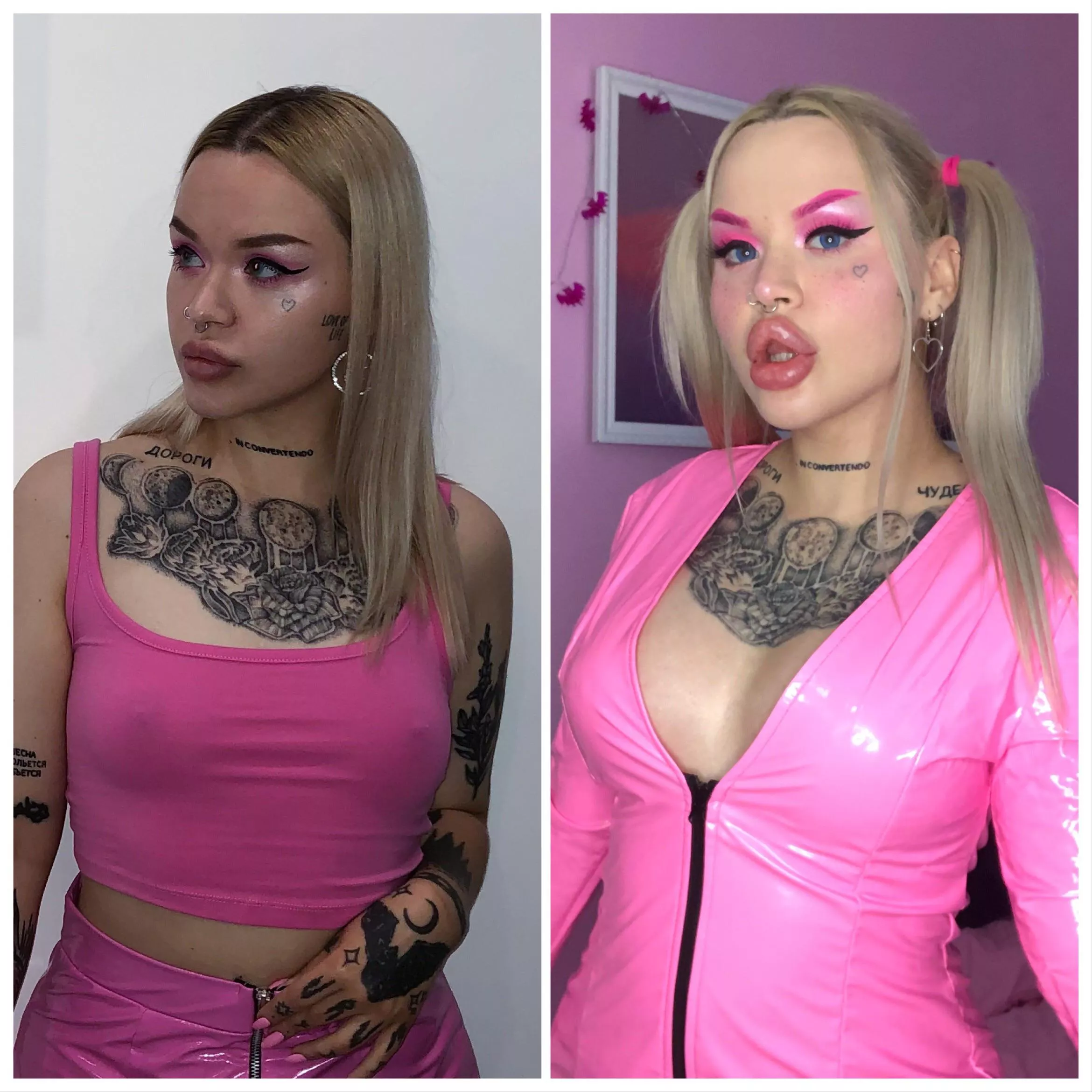 My 1 year progress! I want to get 1000 cc tits so bad, these 450 cc are small for me! But i’m still happy i finally get tits 🥰 posted by nasty_bimbo