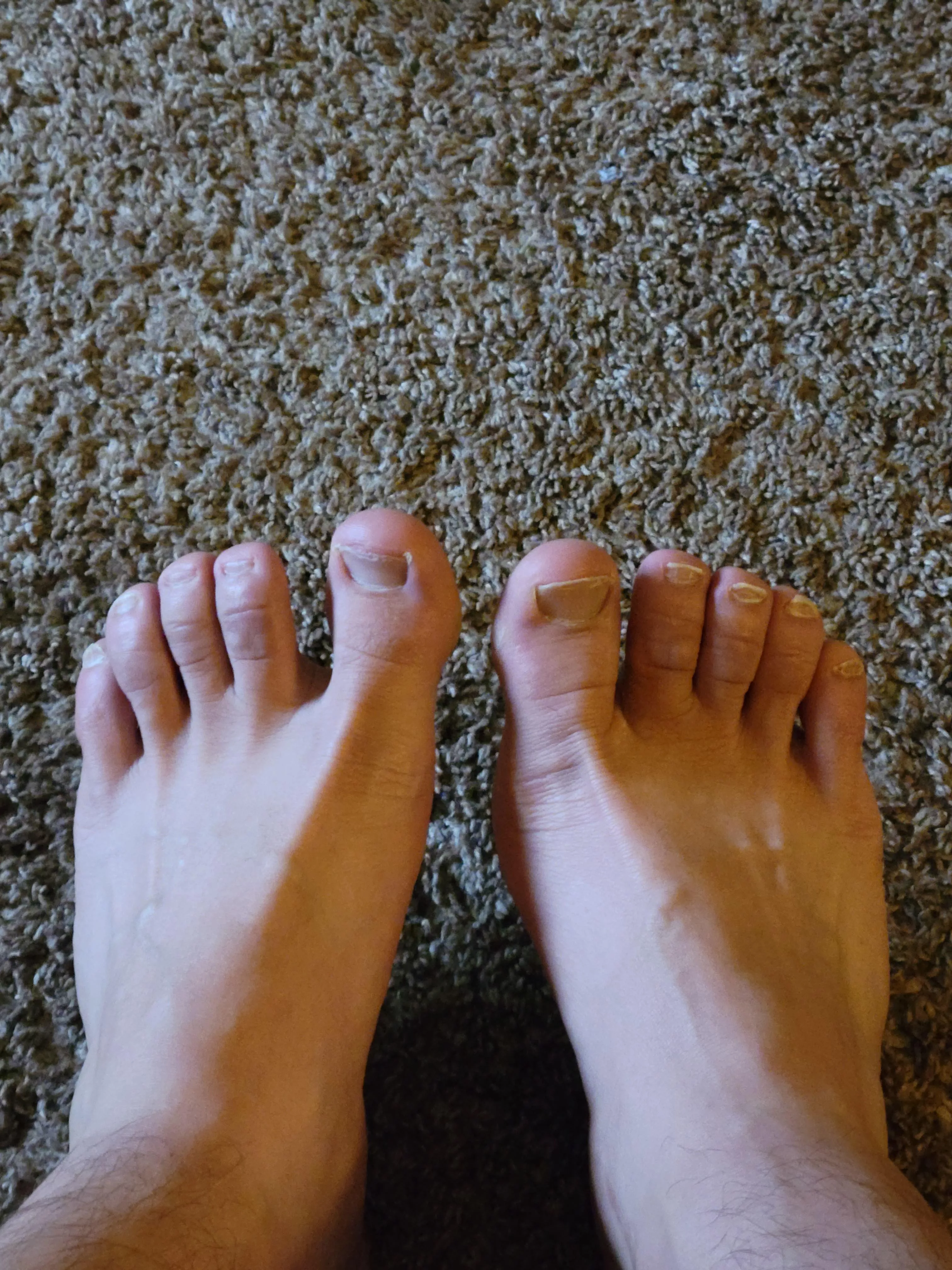 My 2nd ever post. Wanna know what ppl think? Always liked my toes. Hope you do too! posted by bobcrackerus