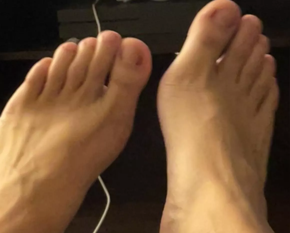 My bare tosies 🥰 posted by Harrypotskins1