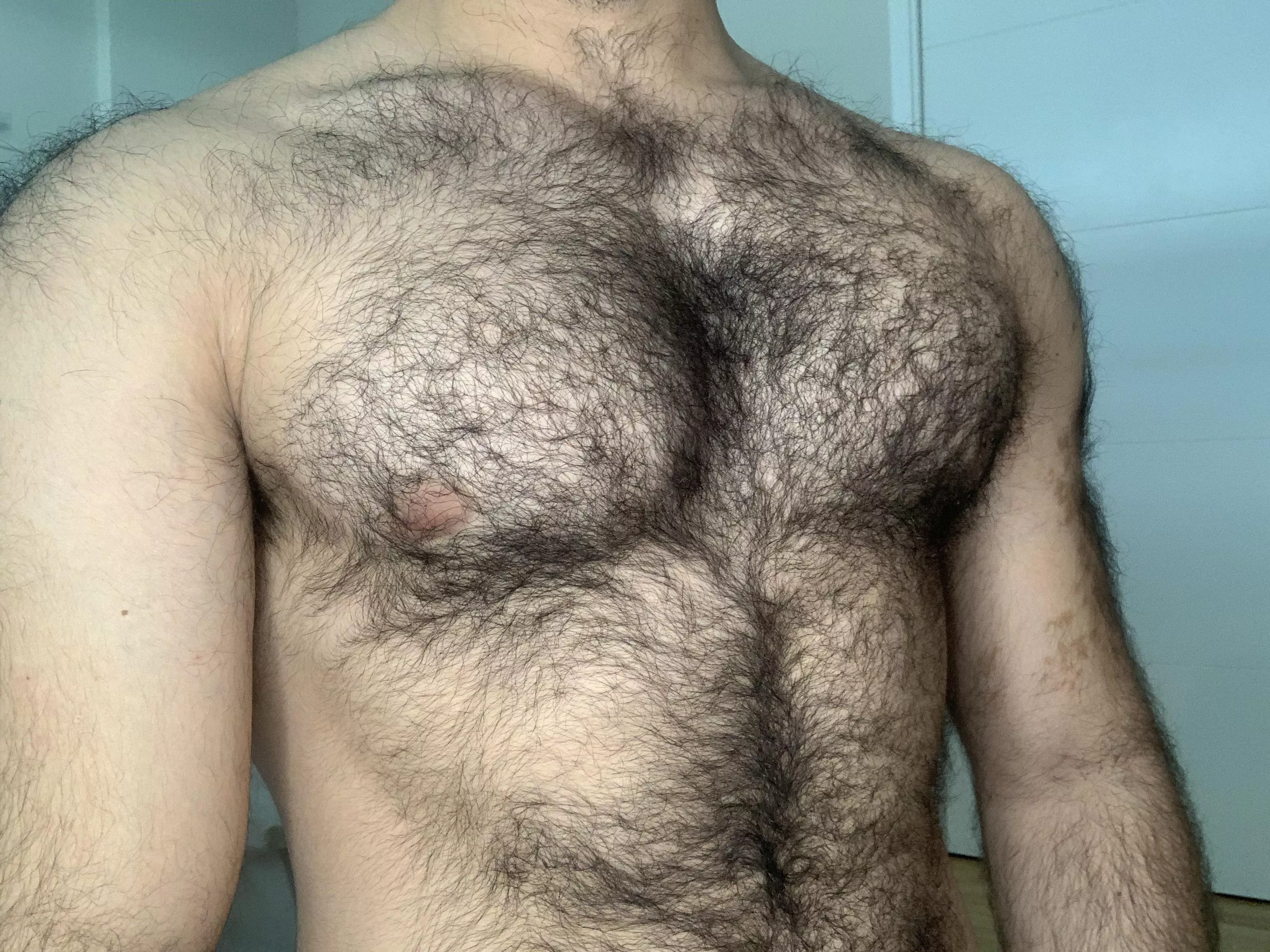 My chest is hairy I think posted by Infected_Mango