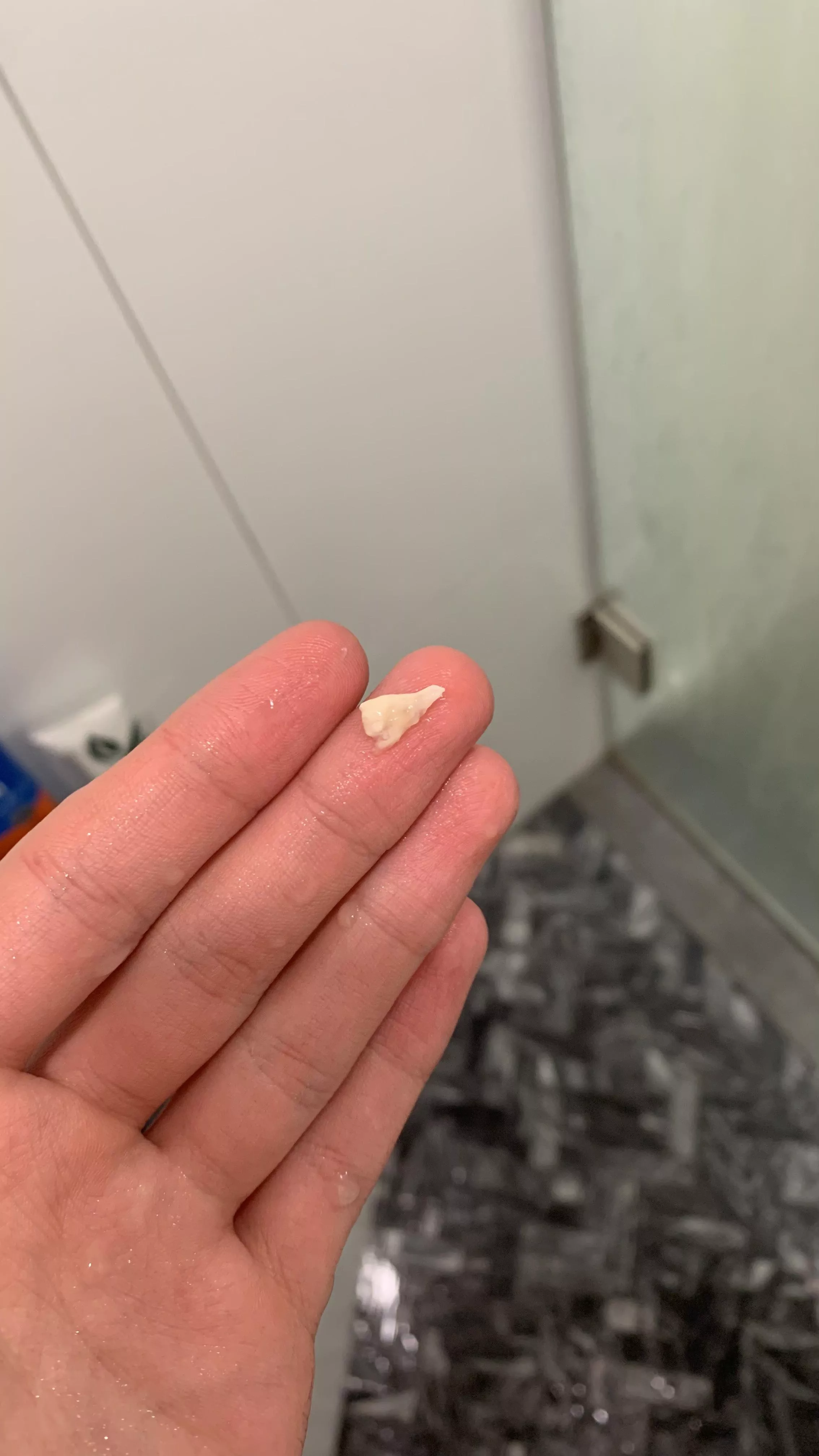 my eye was hurting and watering for the past couple days. pushed on my tear duct for a second and this came out my mouth. immediate relief posted by DuckEatBread