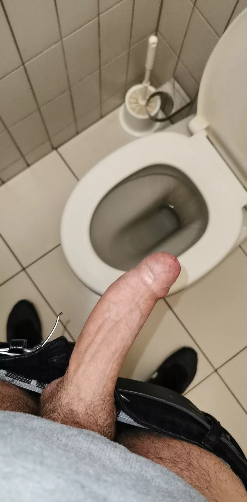 My foreskin is weird right? 😵 posted by Newguyxs