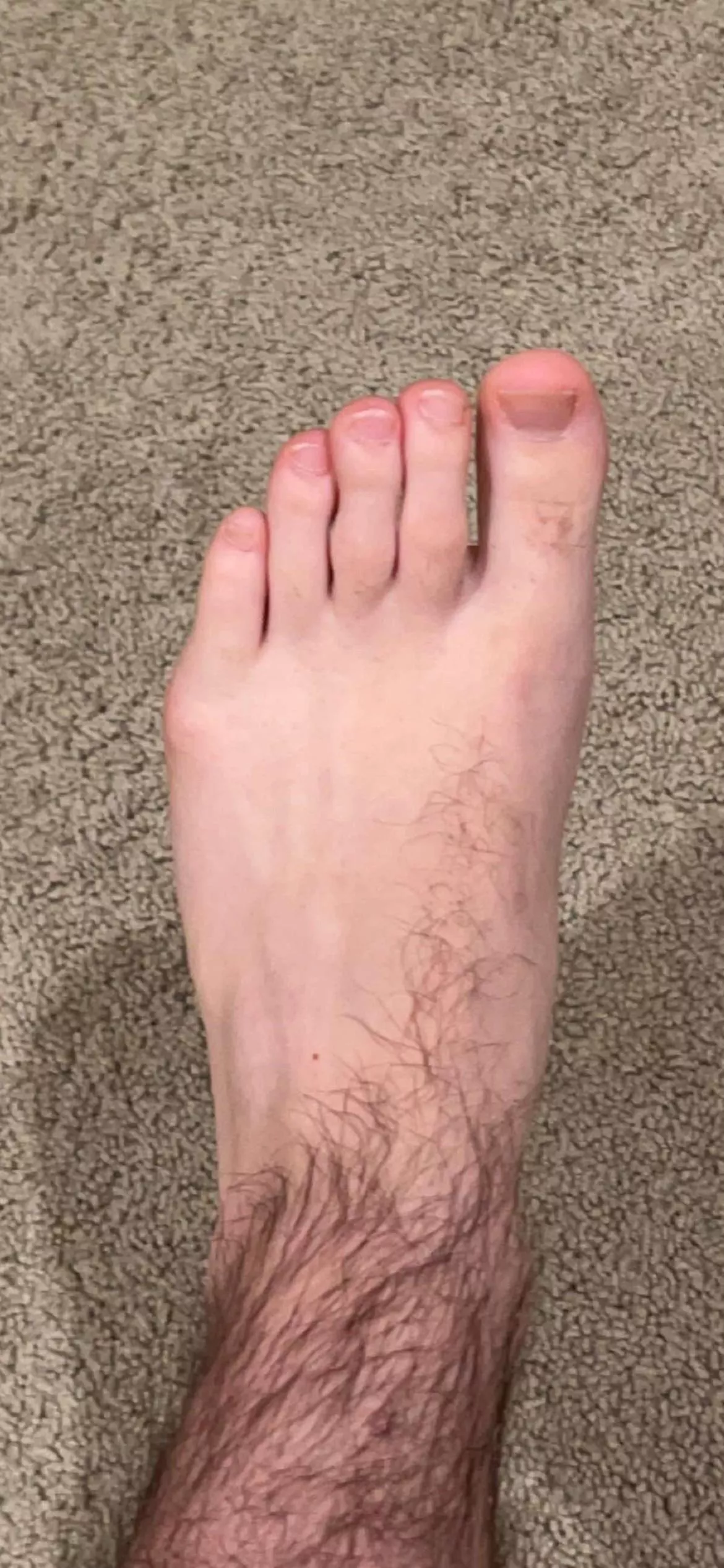 My friend’s stinky feet posted by [deleted]