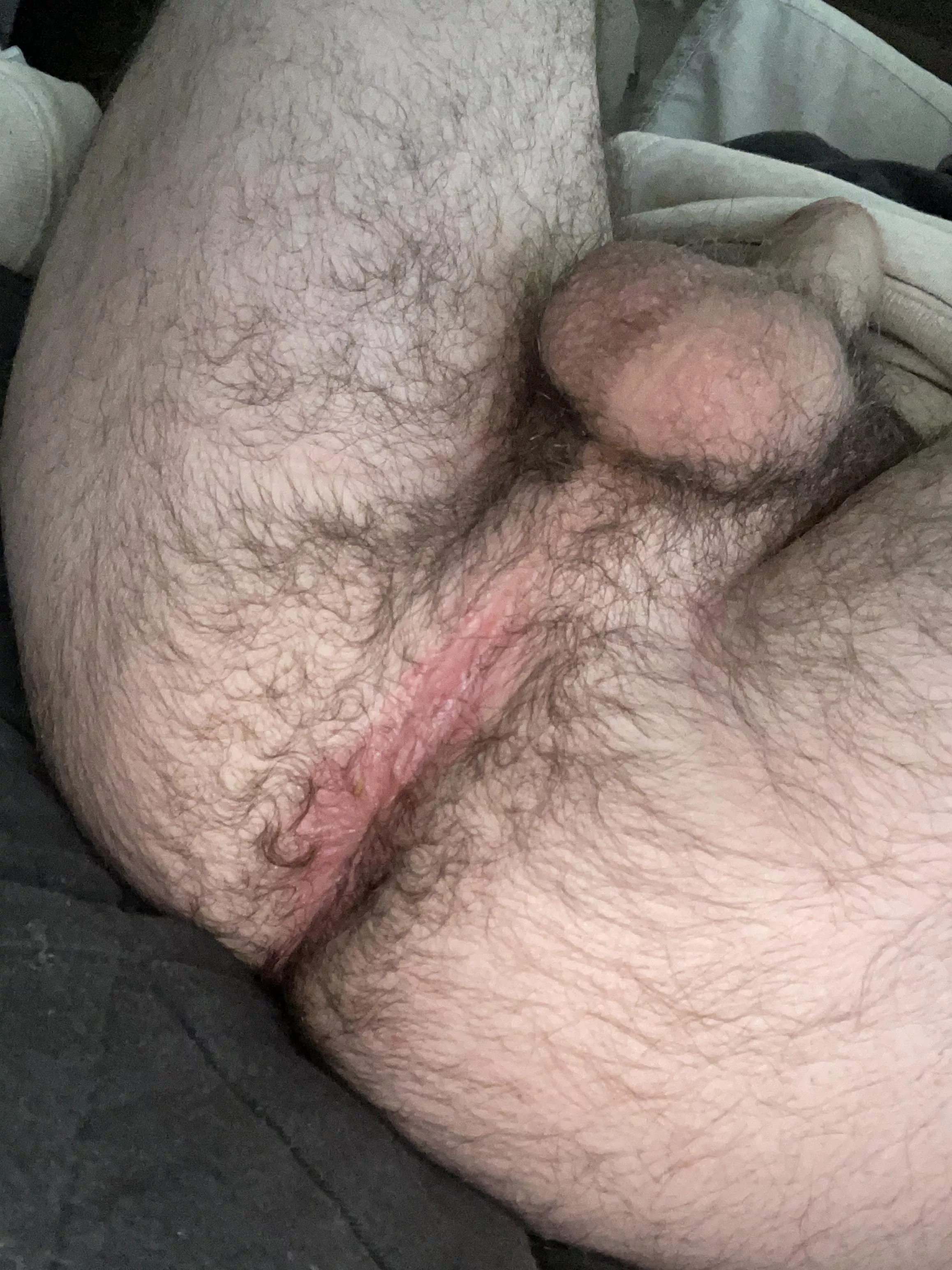 My hairy ass and balls. Anyone wanna taste? posted by nj_xxx