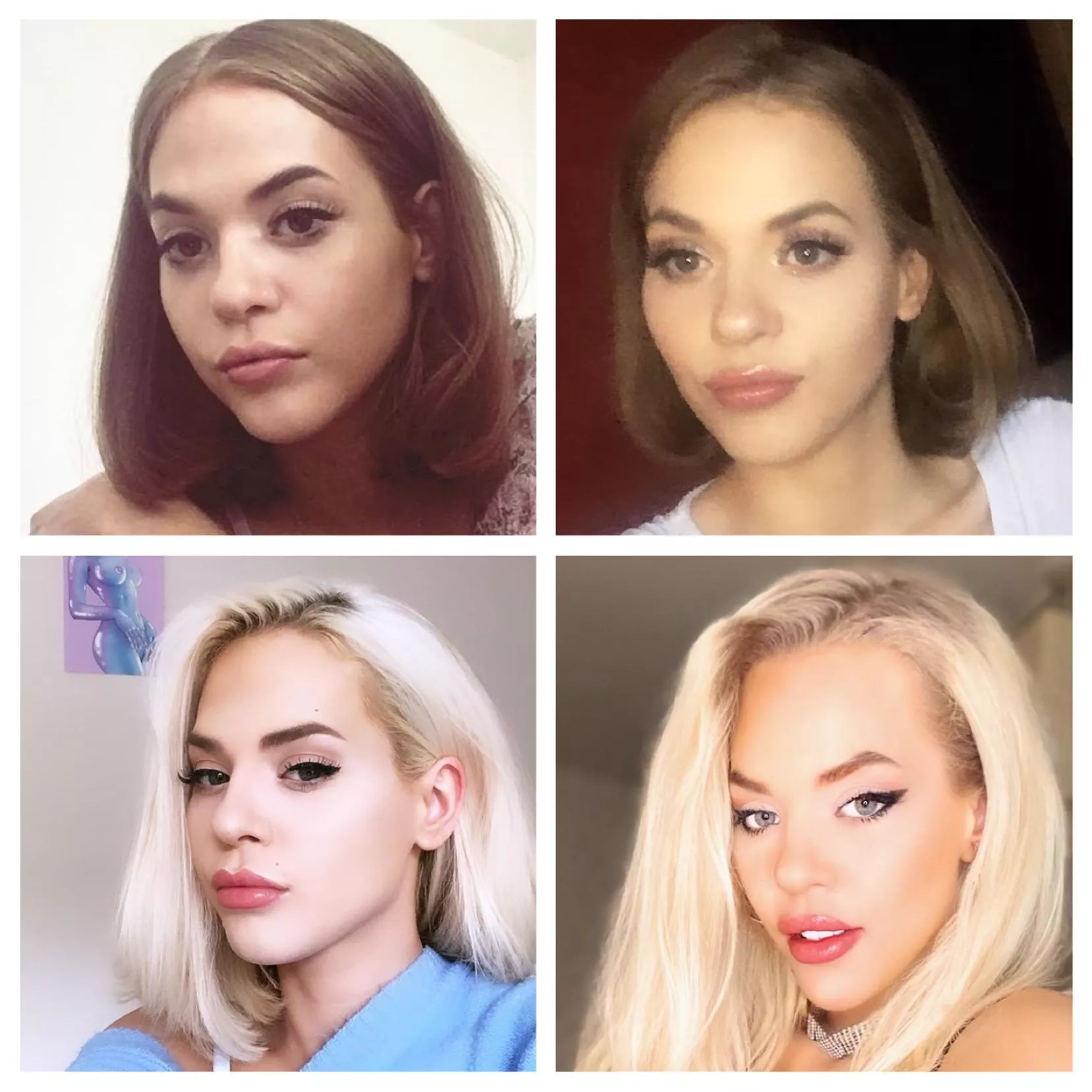 My journey so far ovre the past 3 years(please ignroe my quarantine roots) ; m trying to save for breast implants, a nose job & eyebrow thread lift. If you want to help me fund these, let me know, I want the surgeries as soon as I can and would be su posted by underwearlardface