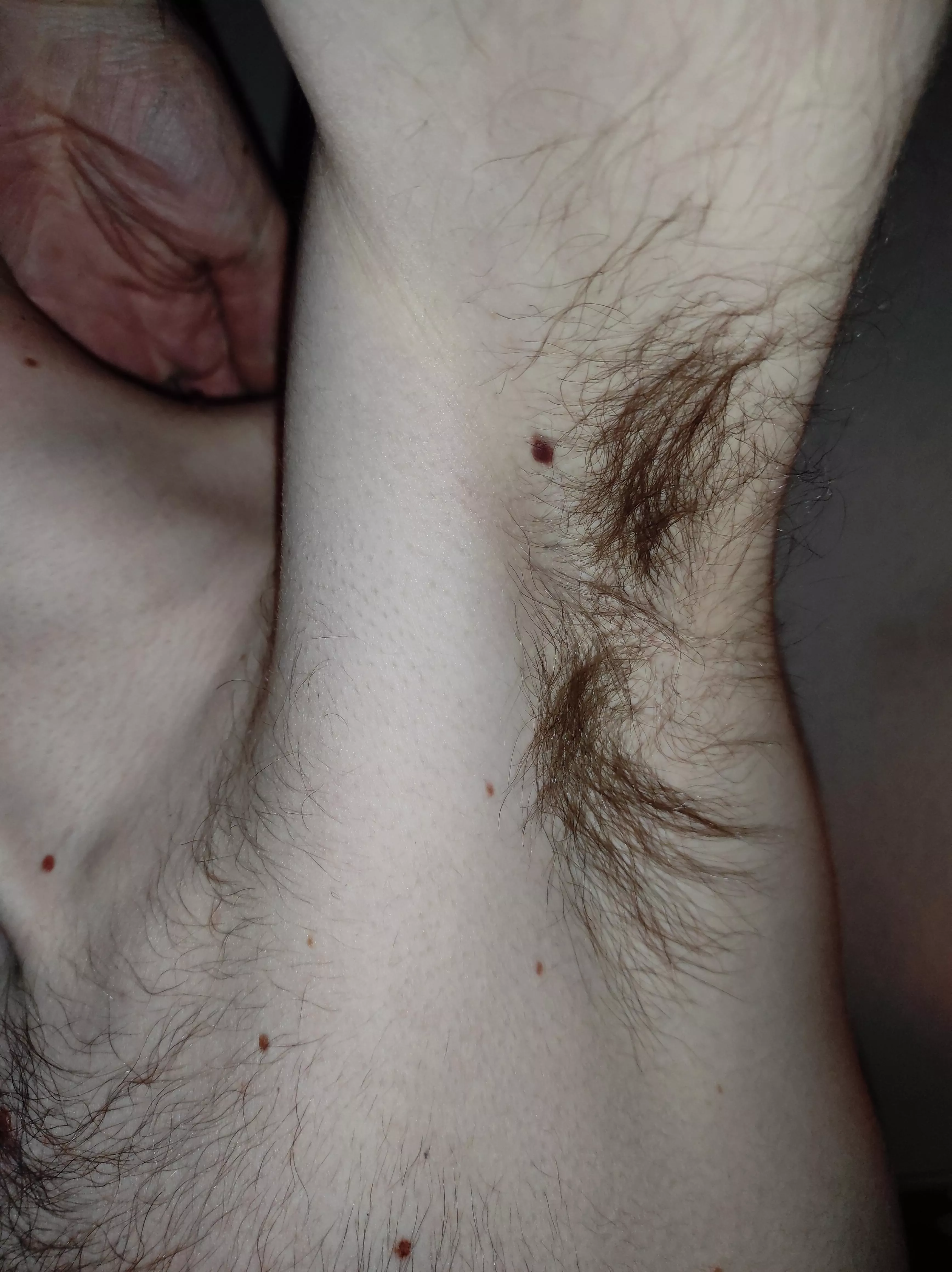 My pits are pretty hairy, aren't they? posted by TheMoonSwimmer