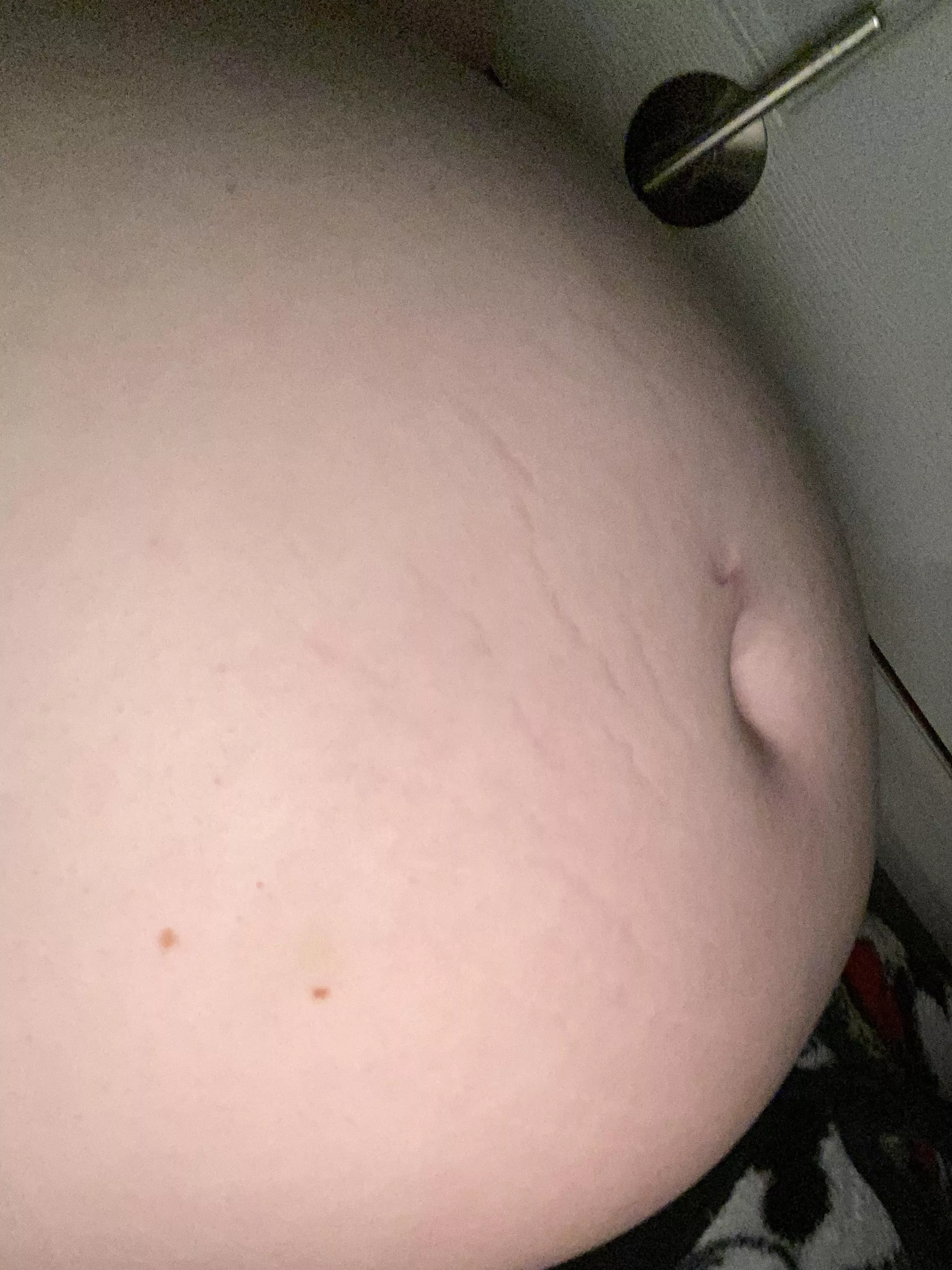 my stretch marks are finally coming in ! posted by No_Task9759