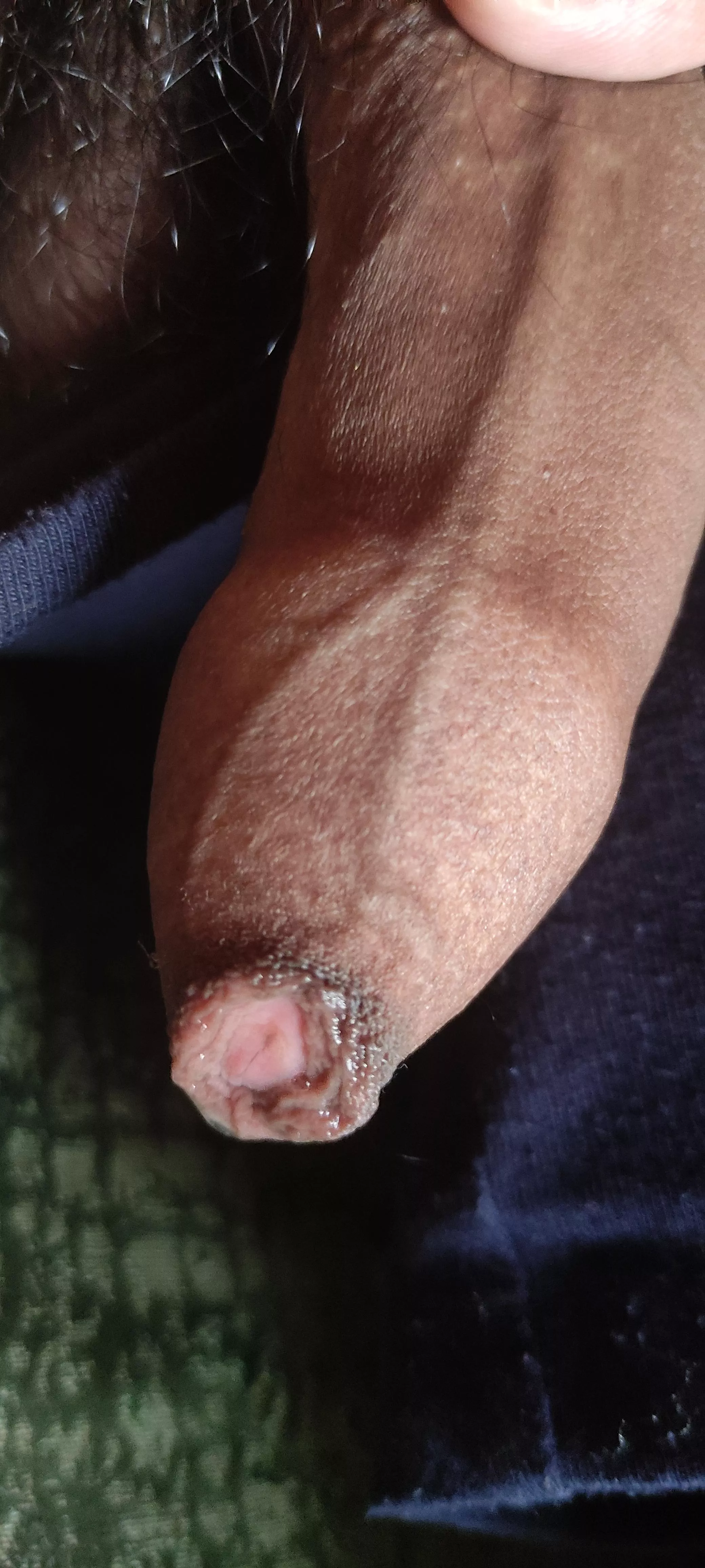 My uncut dick wet with precum... posted by philosopher_69