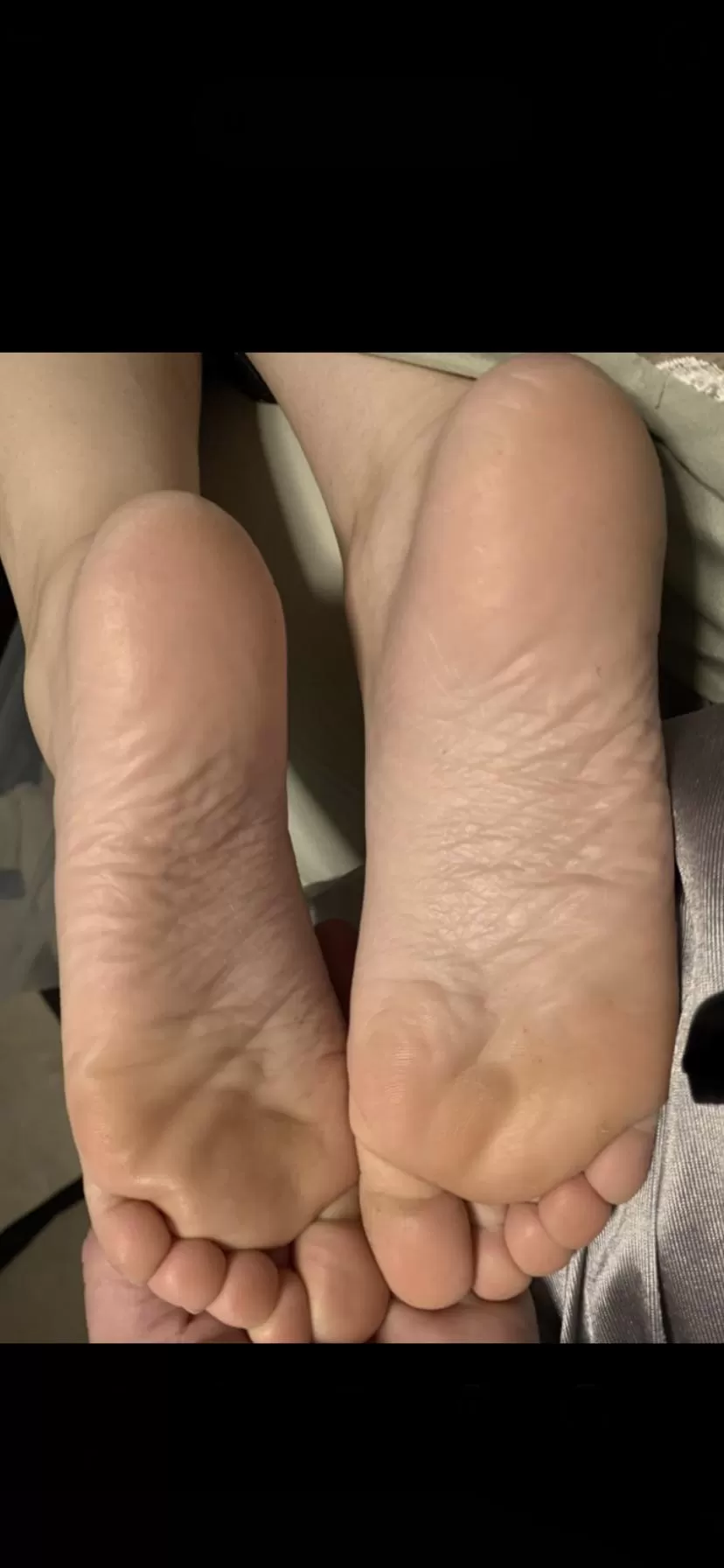 My wife’s wrinkly soles posted by yodamann77