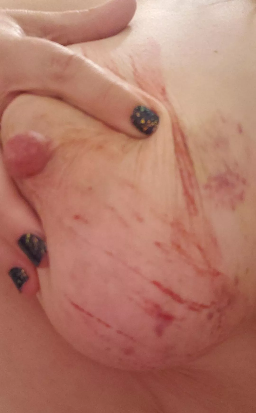 Need more bruises from Daddy's belt on my tits posted by MamaSubX0X0