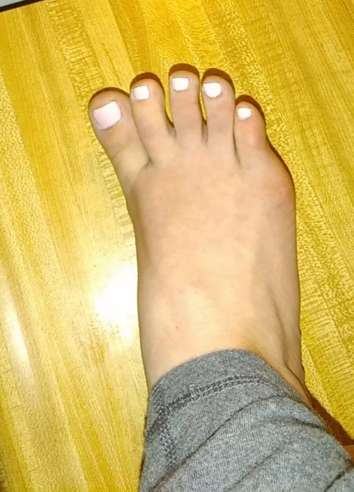 New toe color posted by Daniella_222