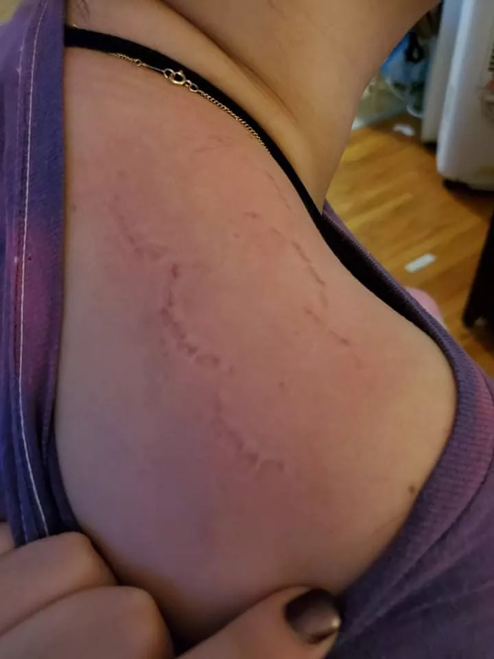 Nothing like a fresh bite mark! I love watching how pink my skin gets posted by PassionsPanties