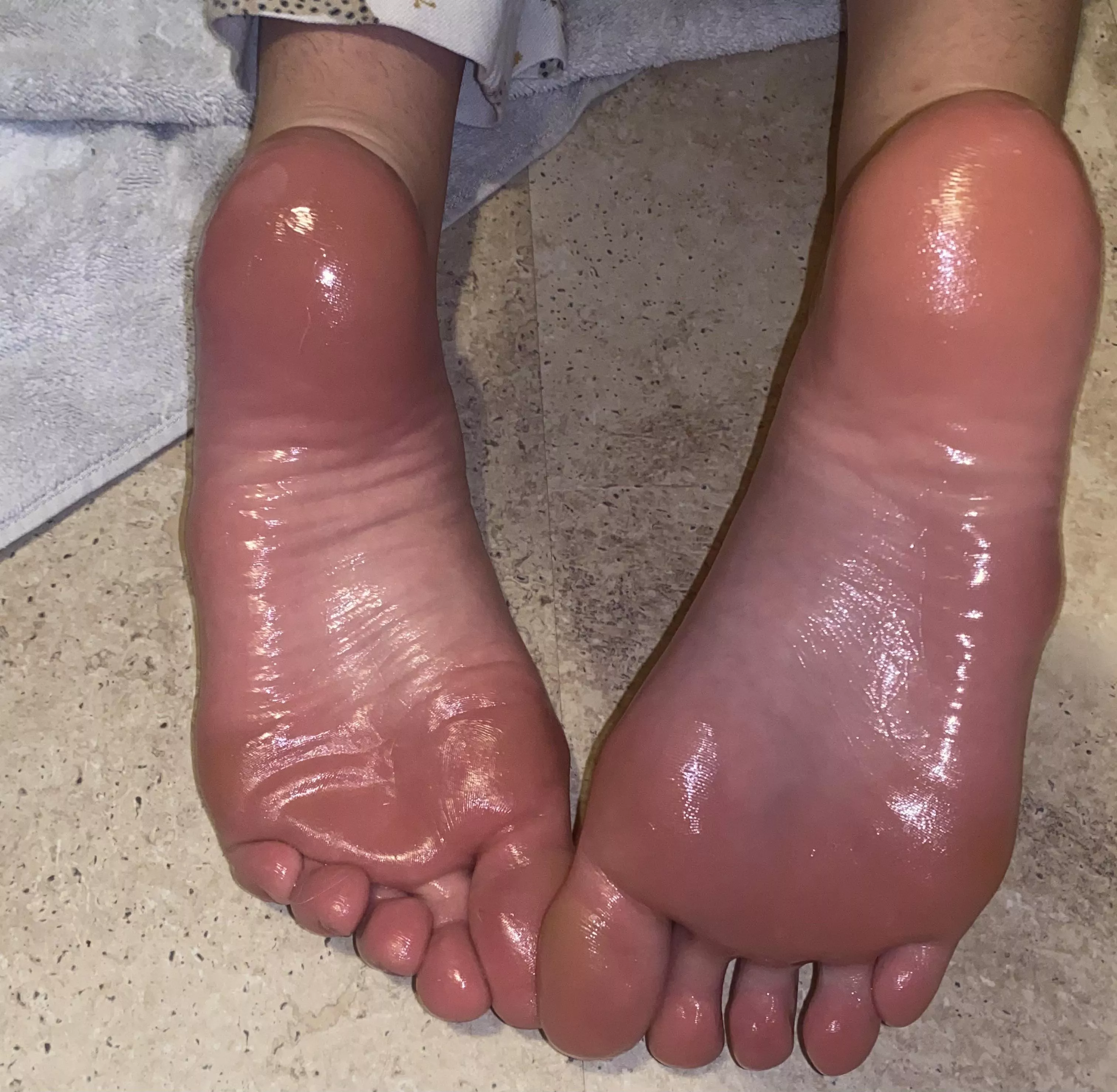 oily soles? posted by sseebehtevas