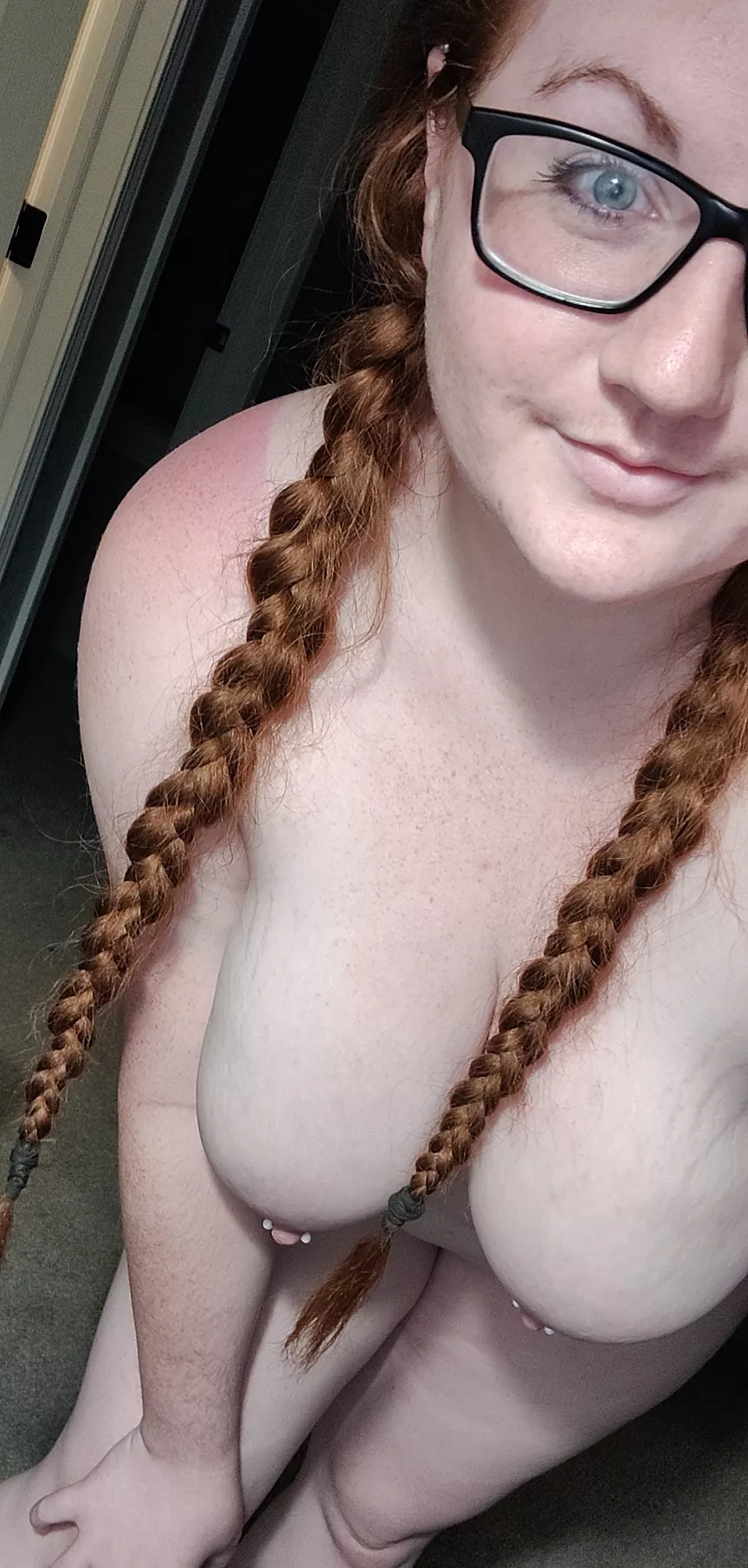 Only downside about being a ginger is the sun hates me 😂 posted by redheadmama3