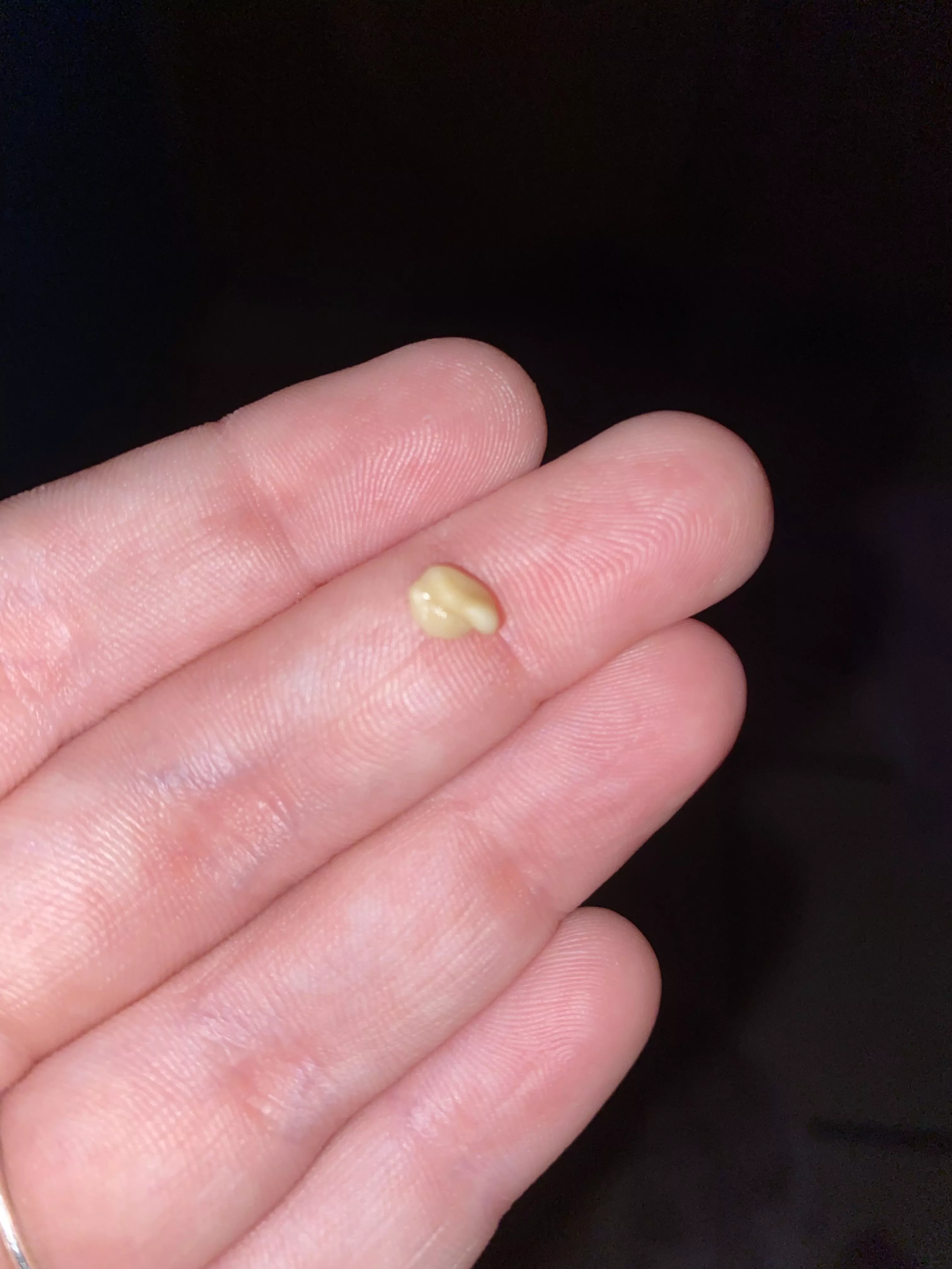 popped this out of my tonsil. i was so surprised!! the human body is crazy yall. i wish i got a video of it. my throat feels so much better posted by Commercial_Pin1909