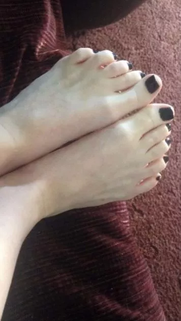 Pretty pale toes 😩 posted by Old-Smile4065