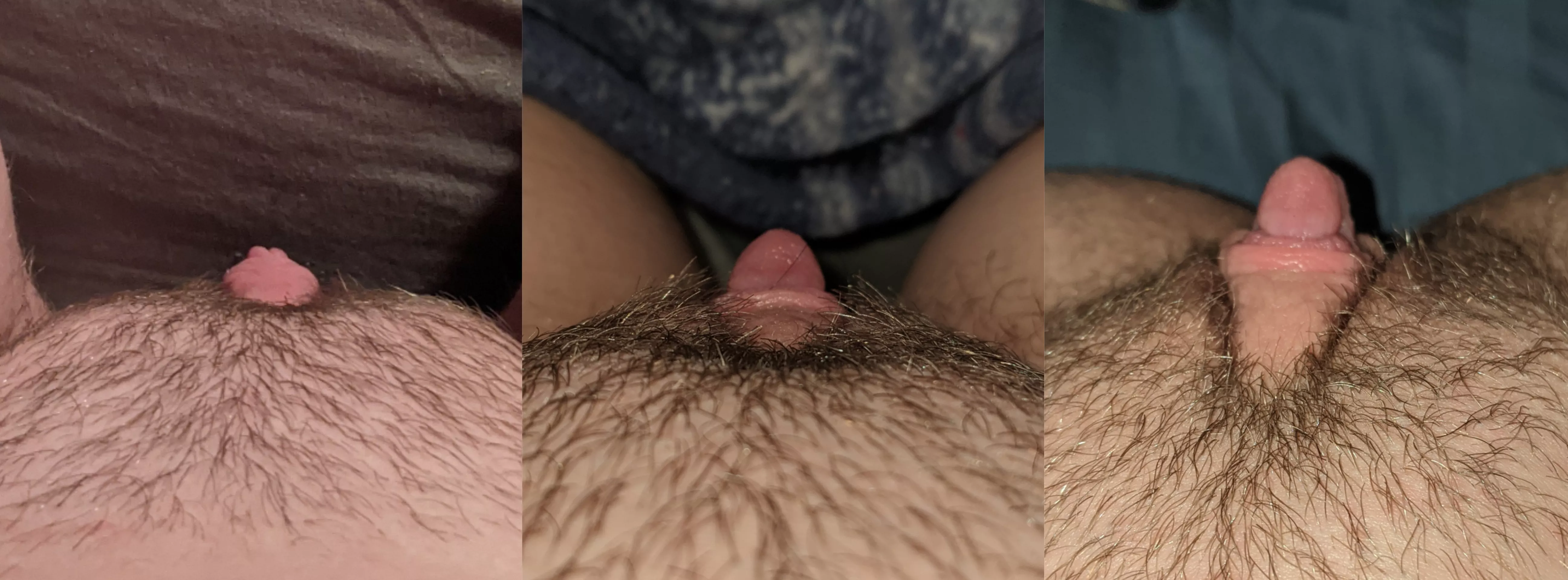 Progression of my clit growth~ 3 weeks on T, first time pumping, and last night after pumping~ posted by imhyperer