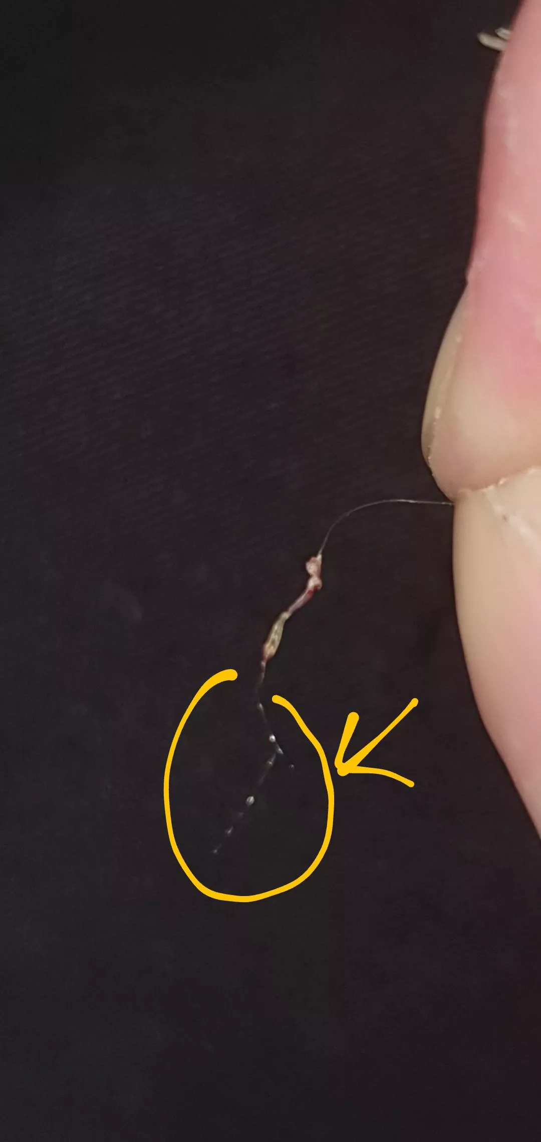 (Pulled hair) So, does anyone here know what these are? posted by commiexander