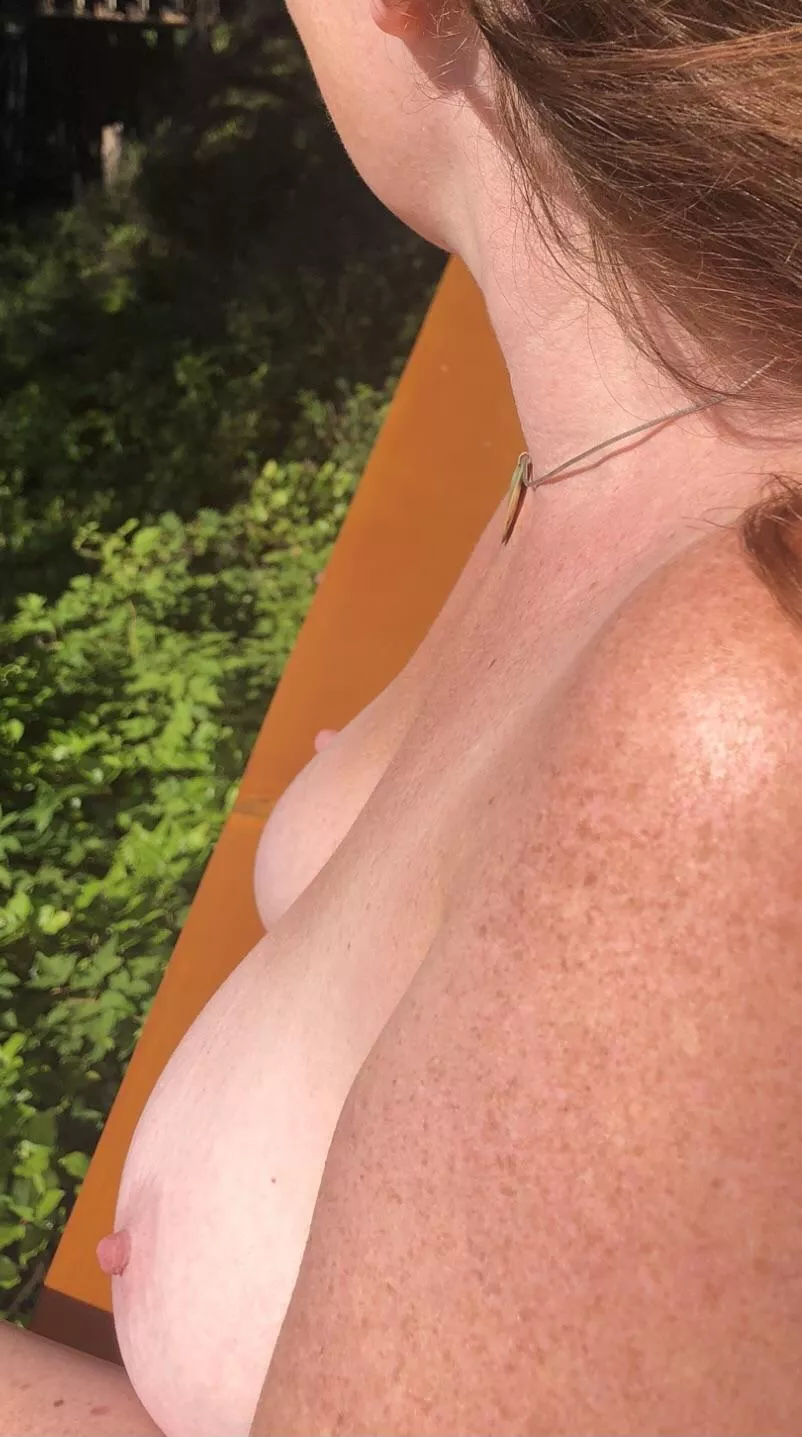 Redhead DD’s freckles in the sun... posted by girlonherknees