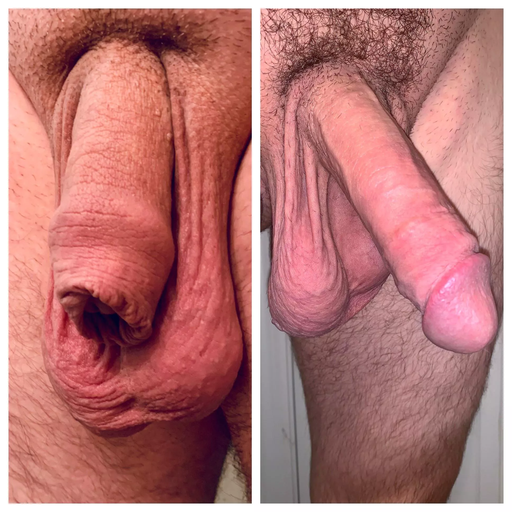 Restored Foreskin here 👋🏻 long ways to go still! posted by CraziRooster