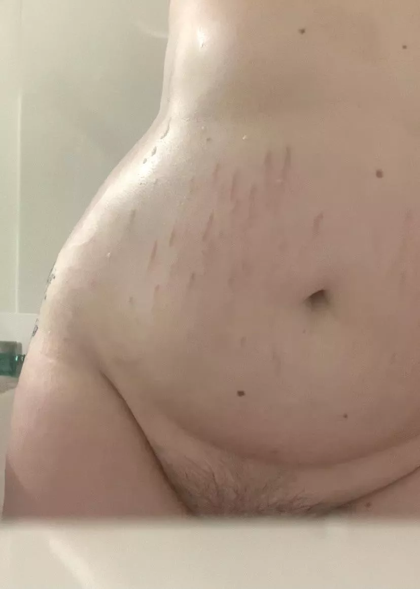 showing off my stretch marks (oc) ðŸ’˜ posted by wetkittyjan