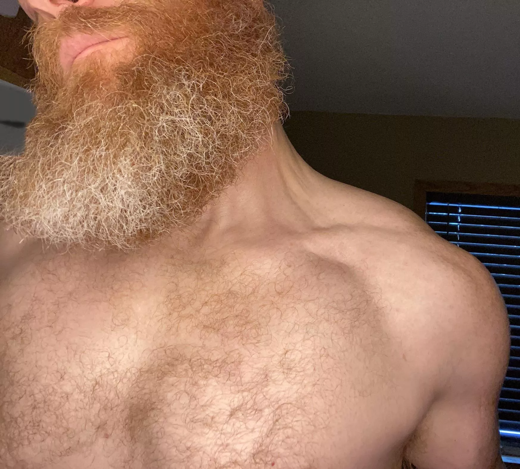 So pale So beard posted by DeFoerest