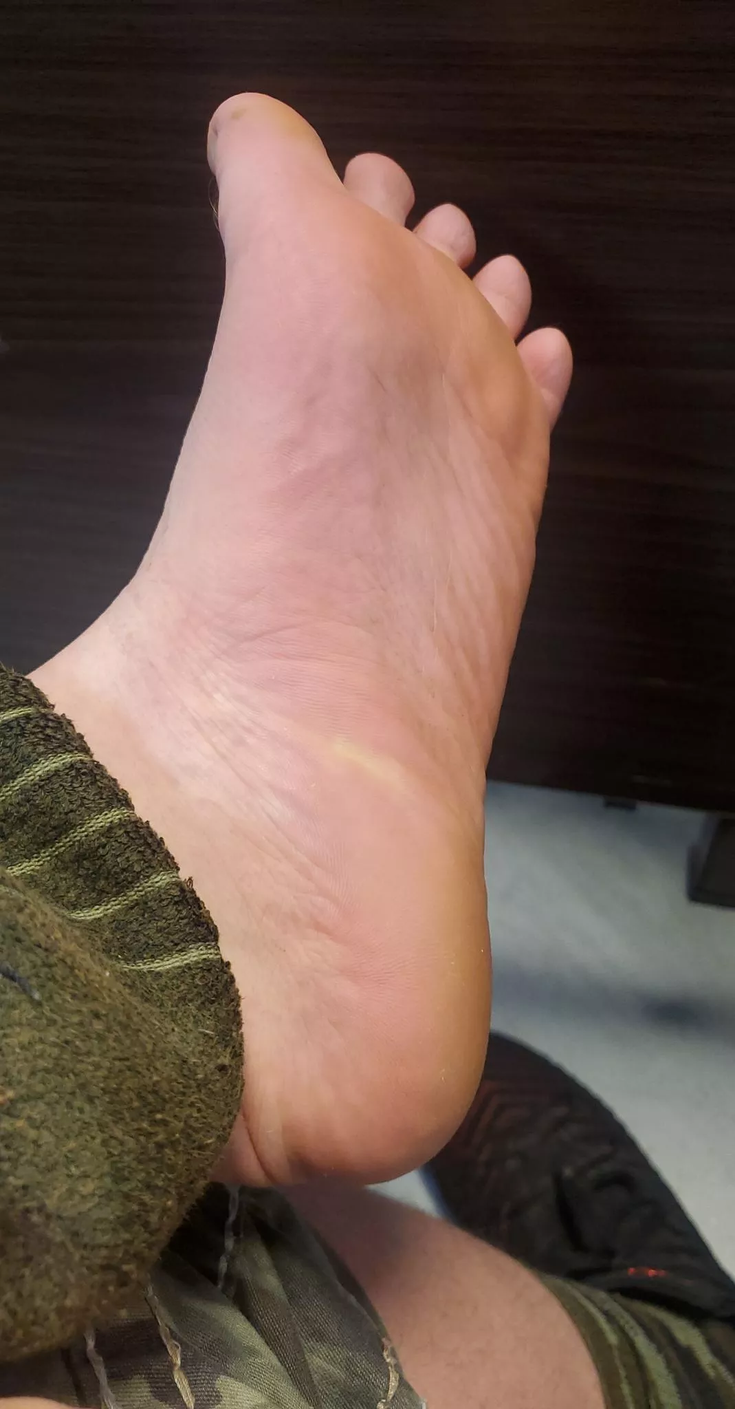 Soles after working in a Warehouse all day posted by Bearfoot_Demon