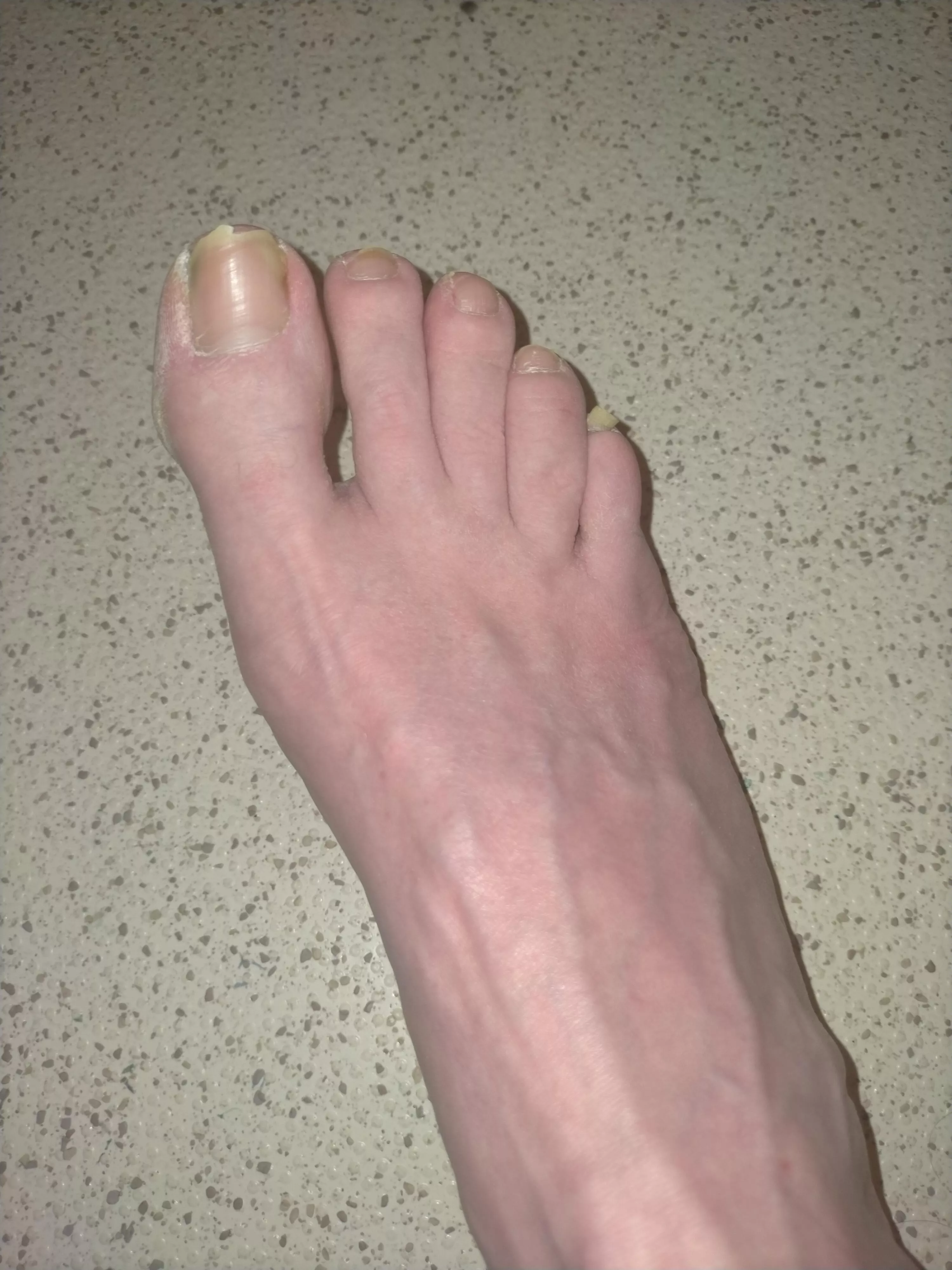 Someone play with my dirty size 13 (UK) feet. posted by ukcutginge