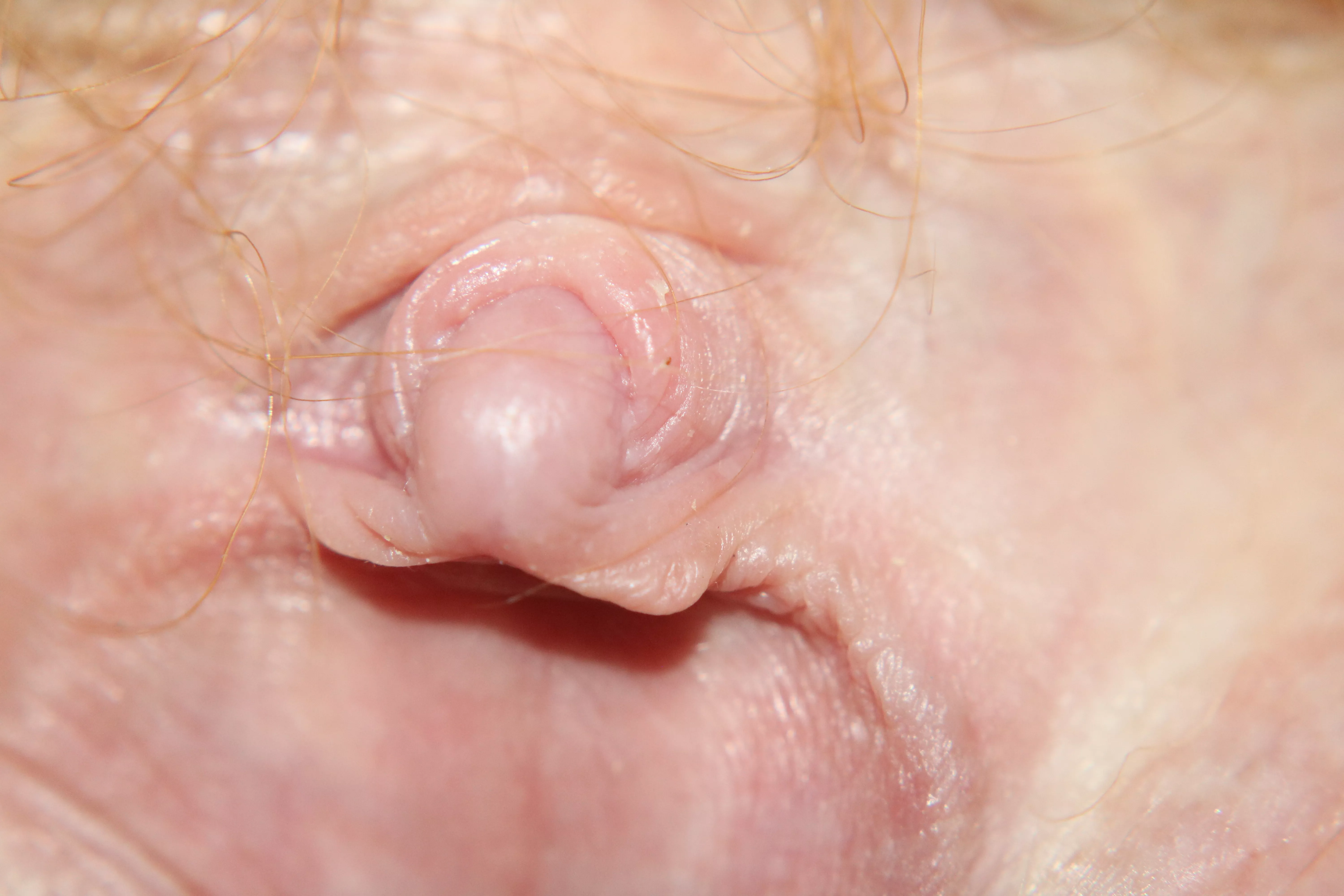 Super Close up of Wife's Clit! posted by frogtreetree