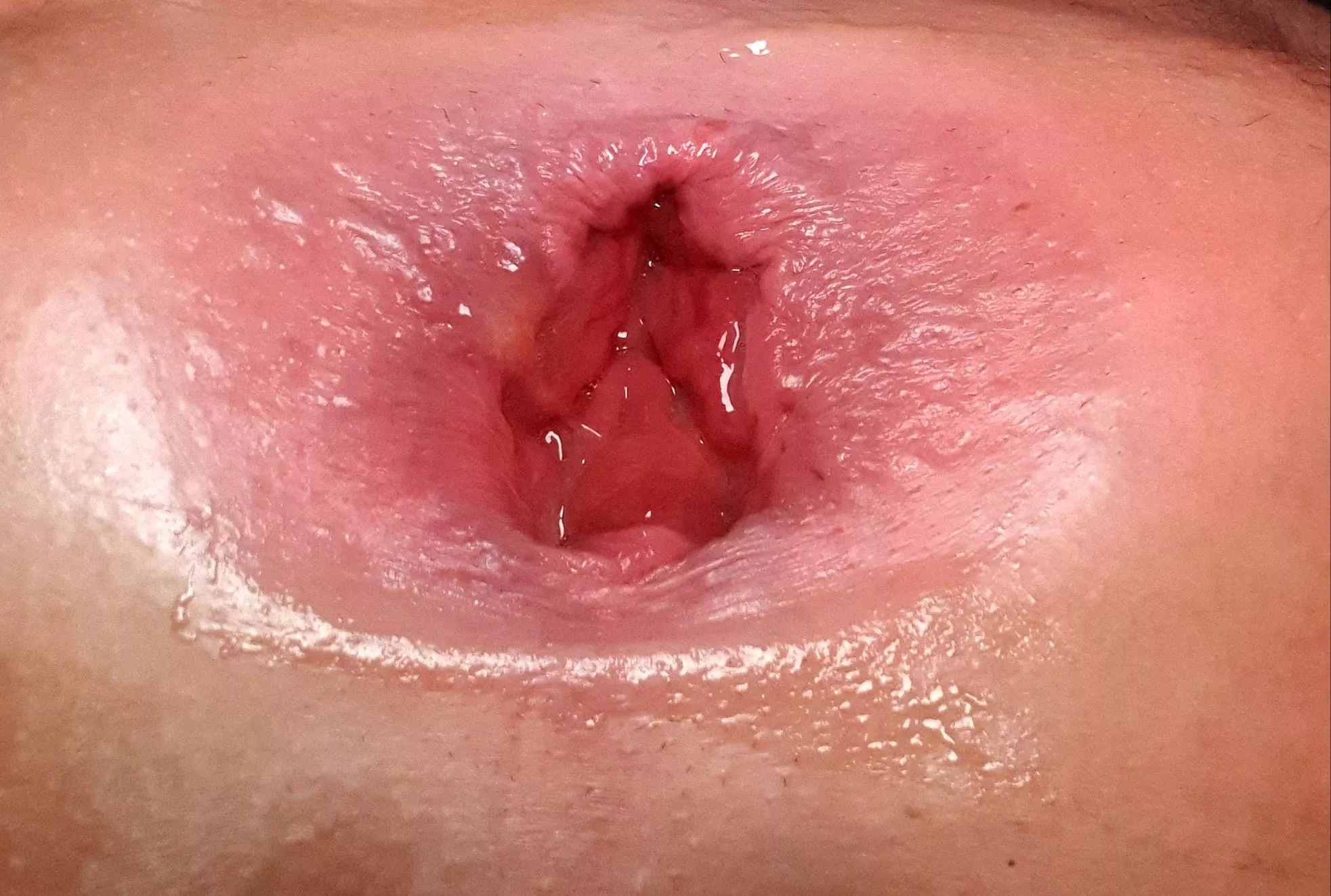 Swollen after tonight 😋 posted by IncogReddit12