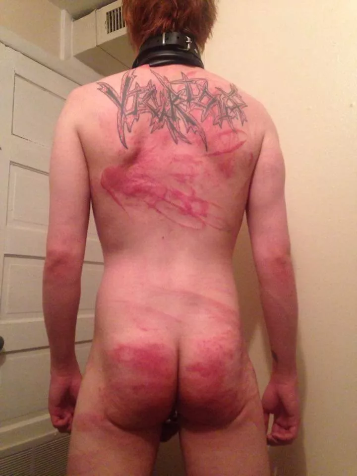 The aftermath of the hardest beating i ever got posted by WyattMadrox