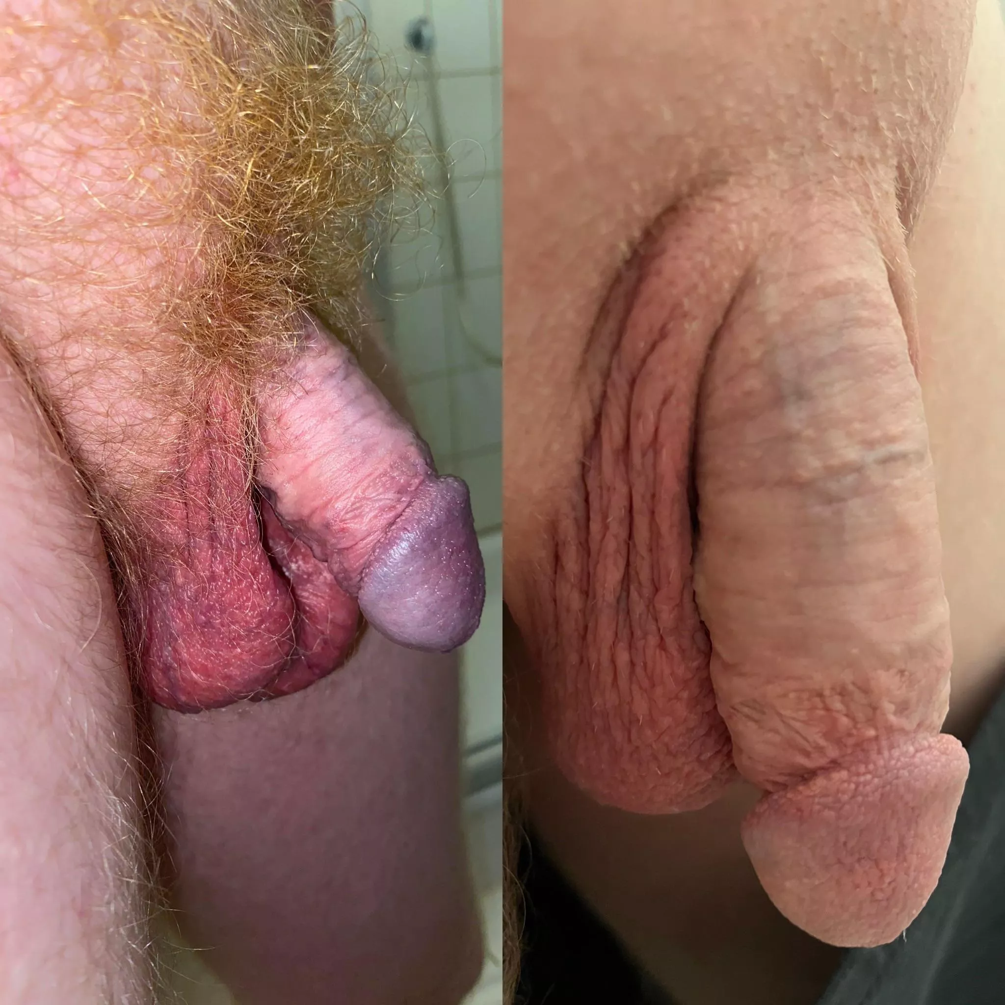 The bush is gone ! What do you think ? posted by cutgingerdick87