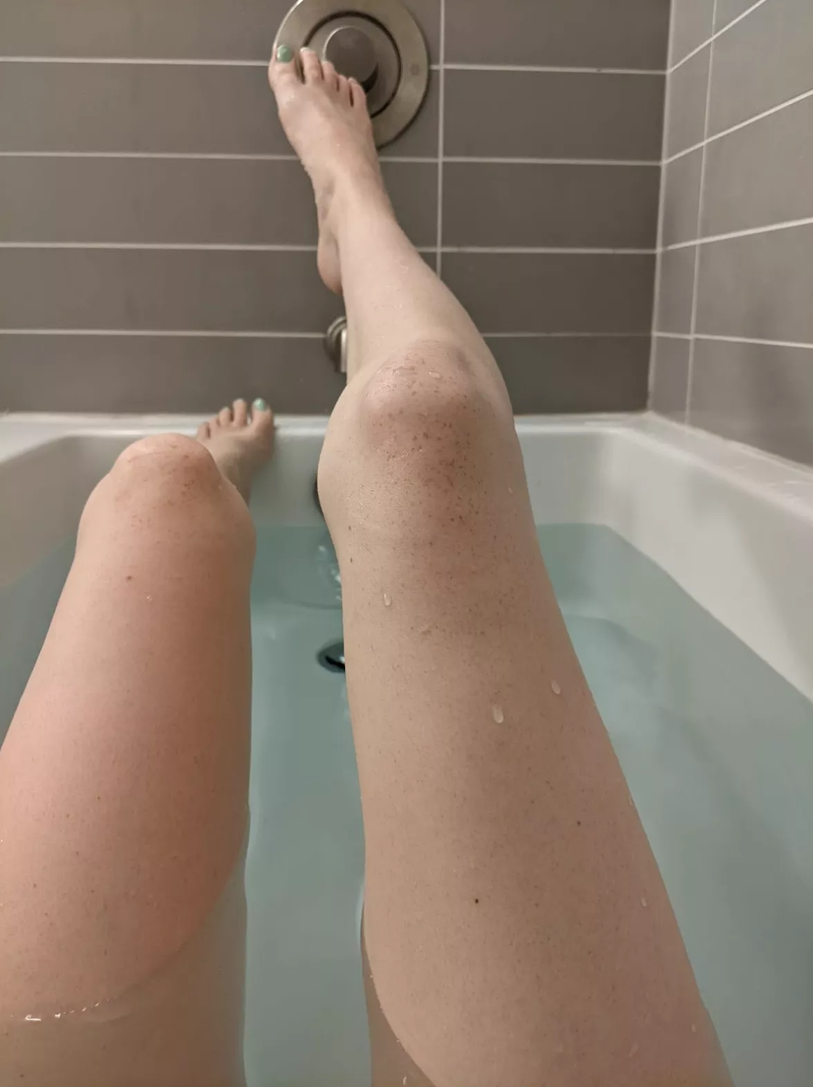 the hot water really brings out the freckles on my legs :) posted by weegingergirl